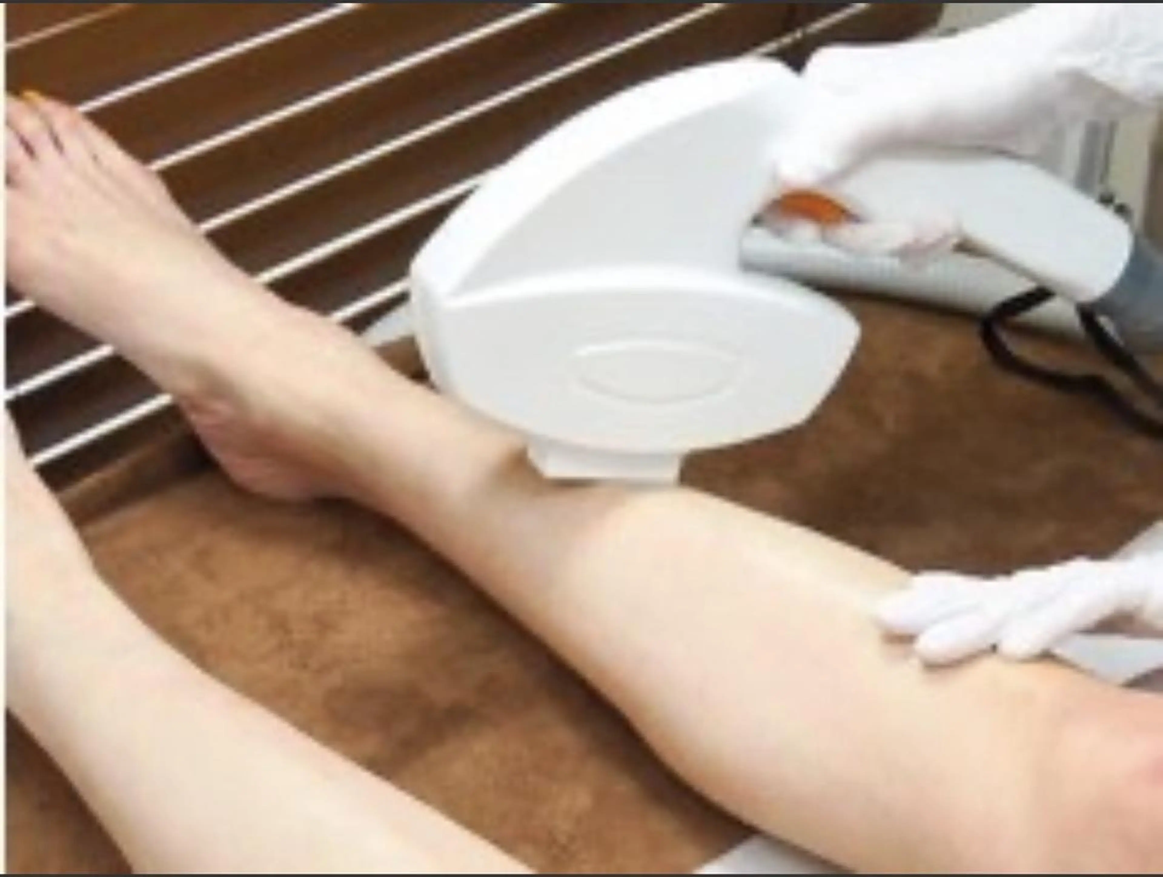 【女性全員】全身光脱毛(VIO込/お顔なし)の写真