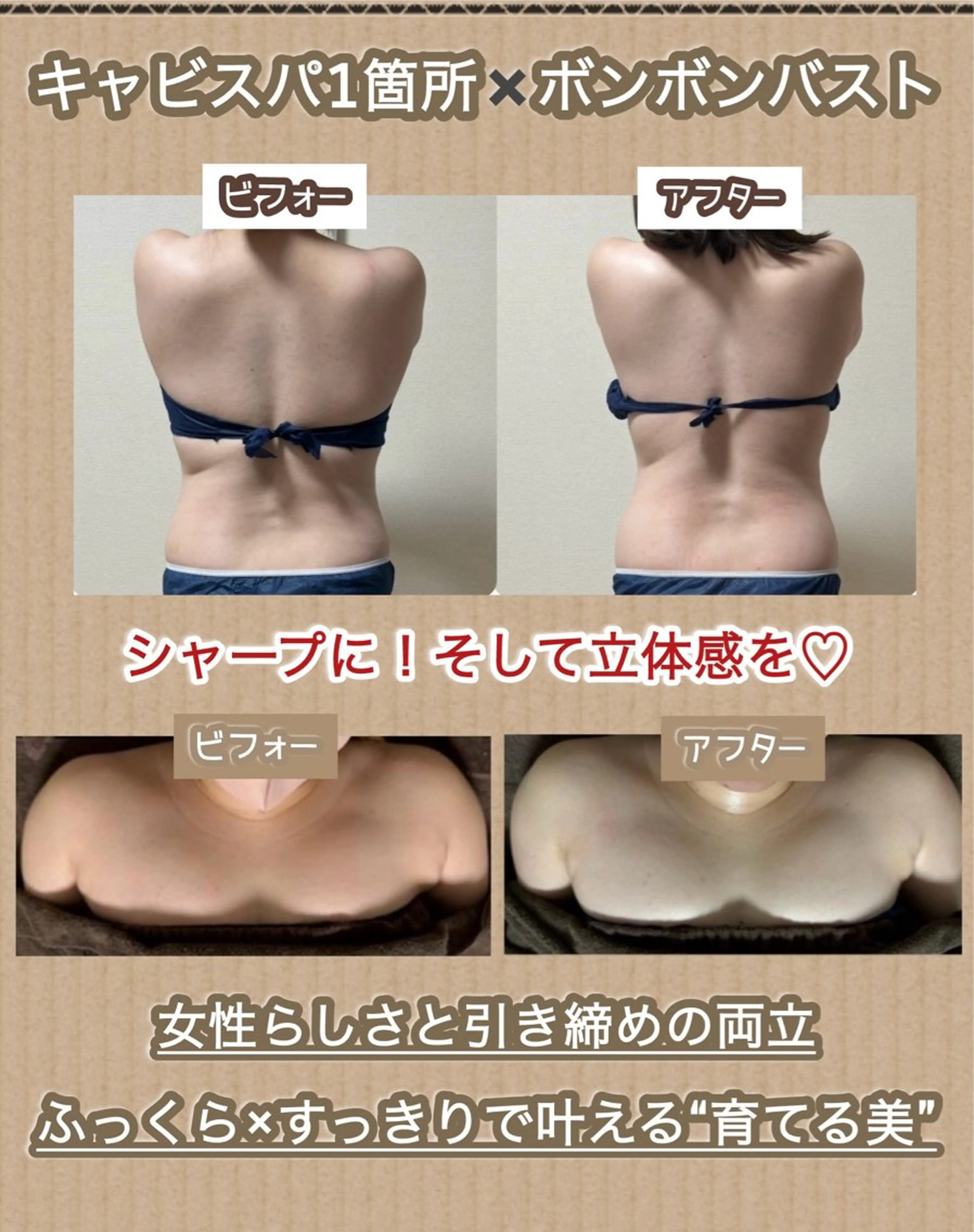 初回限定　キャビスパ1箇所×ボンボンバストの写真