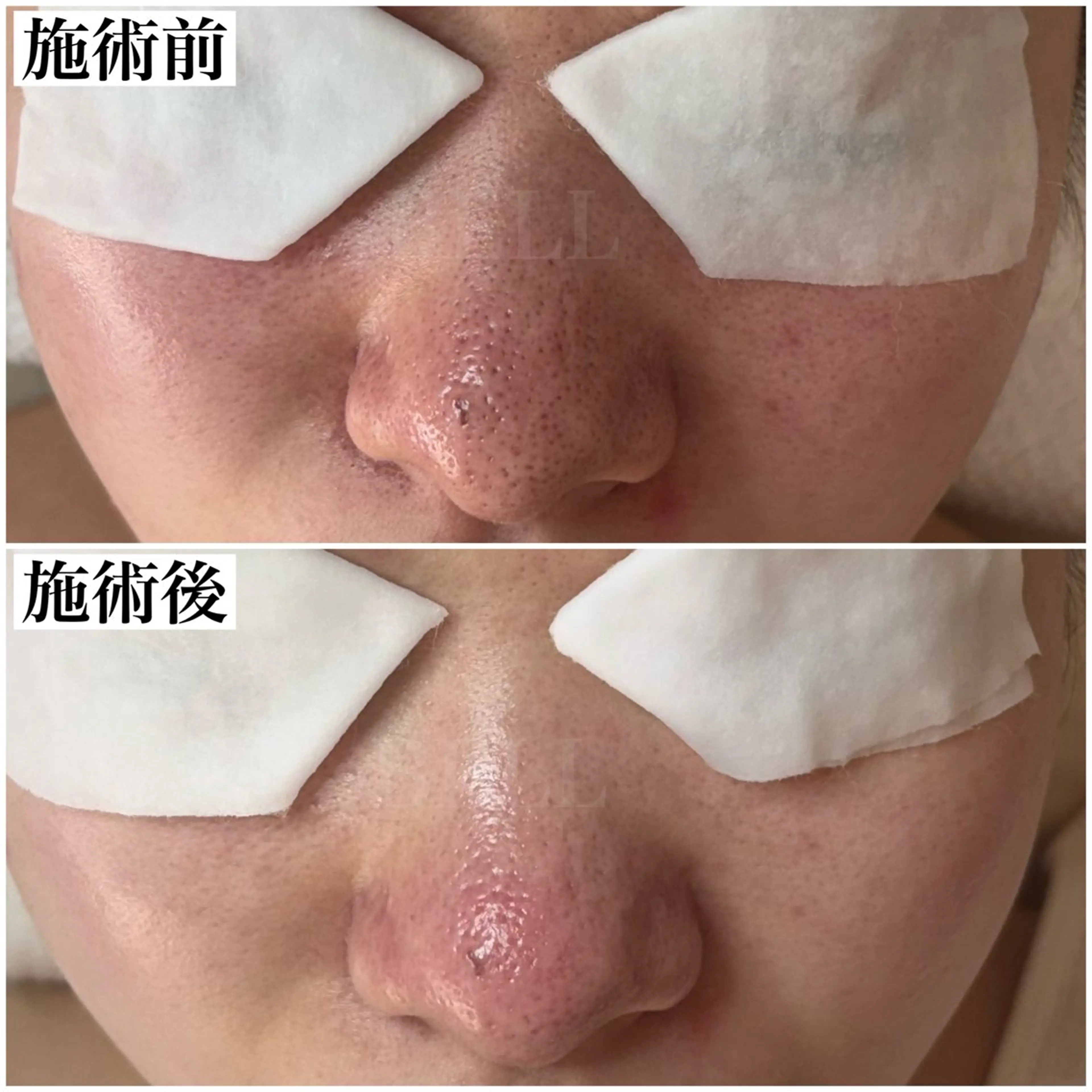 BEAUTY SALON BeLL所属・毛穴ケア専門店 BeLL ベルのエステ・リラクイメージ