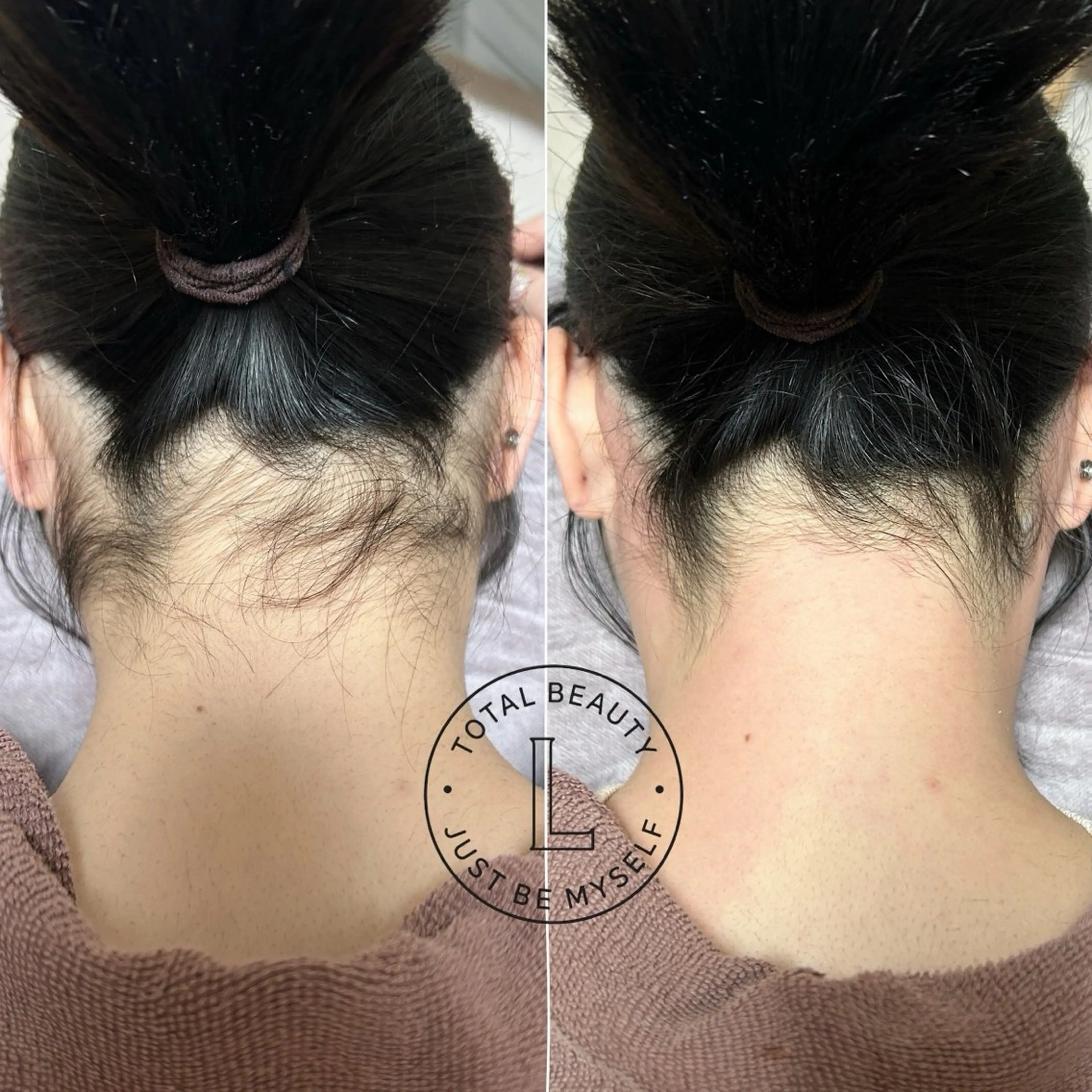 脱毛サロンLULA 恵比寿店　笠松のエステ・リラクイメージ