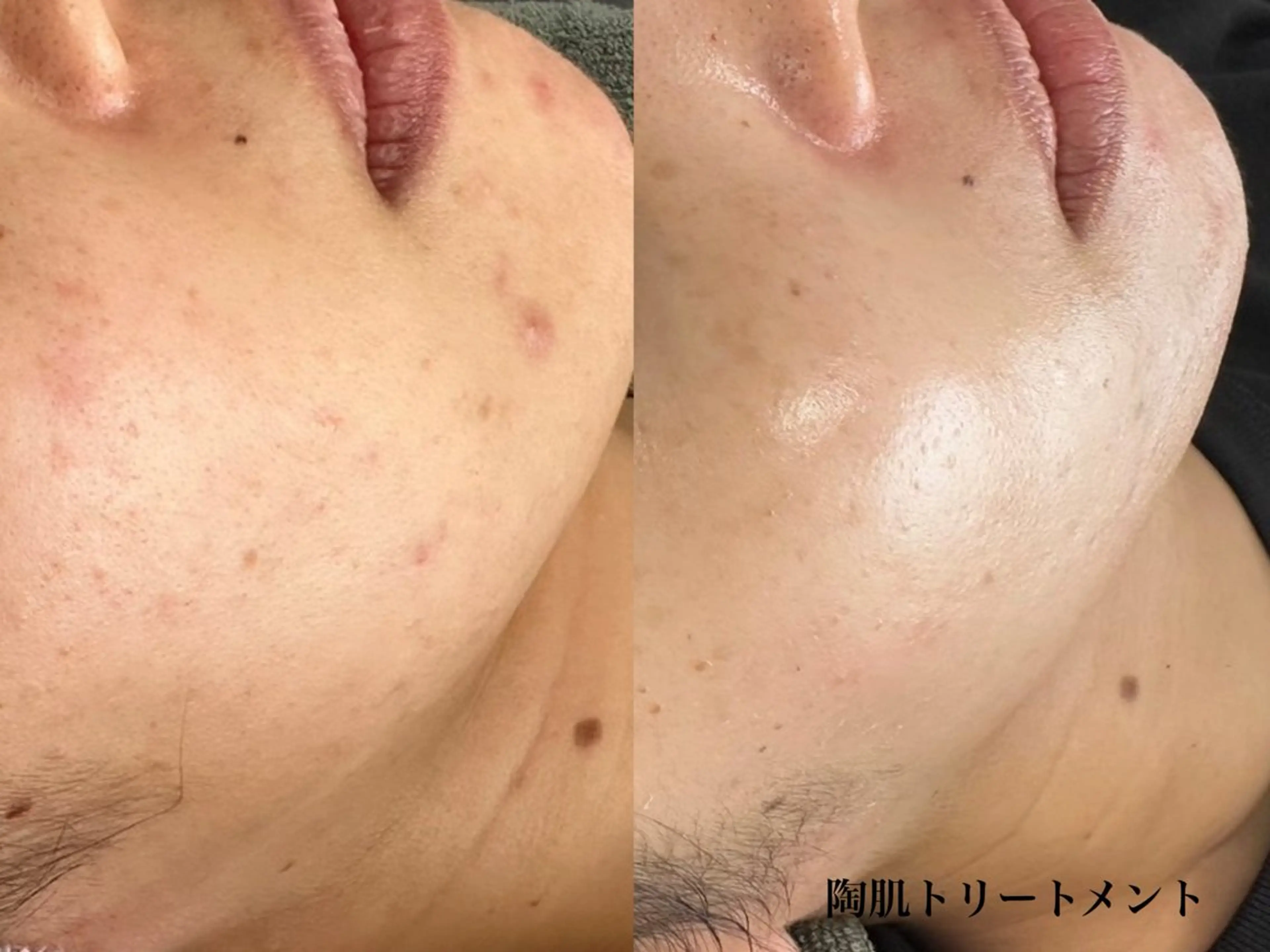 Moonsun kaho豊田市のエステ・リラクイメージ