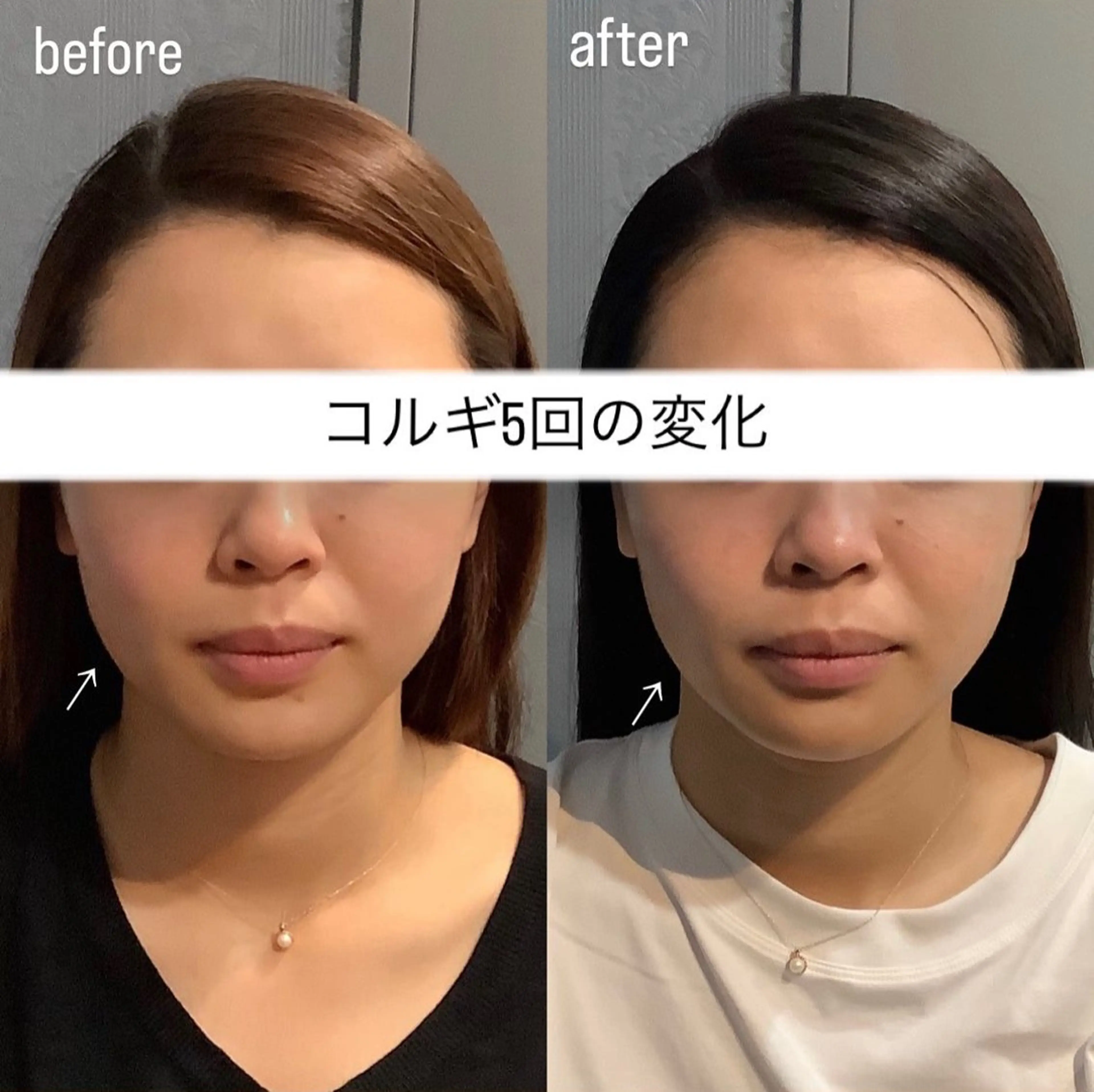 エステ リラク エステサロンino.colore'所属・小顔サロン ino.coloreのエステ・リラクイメージ