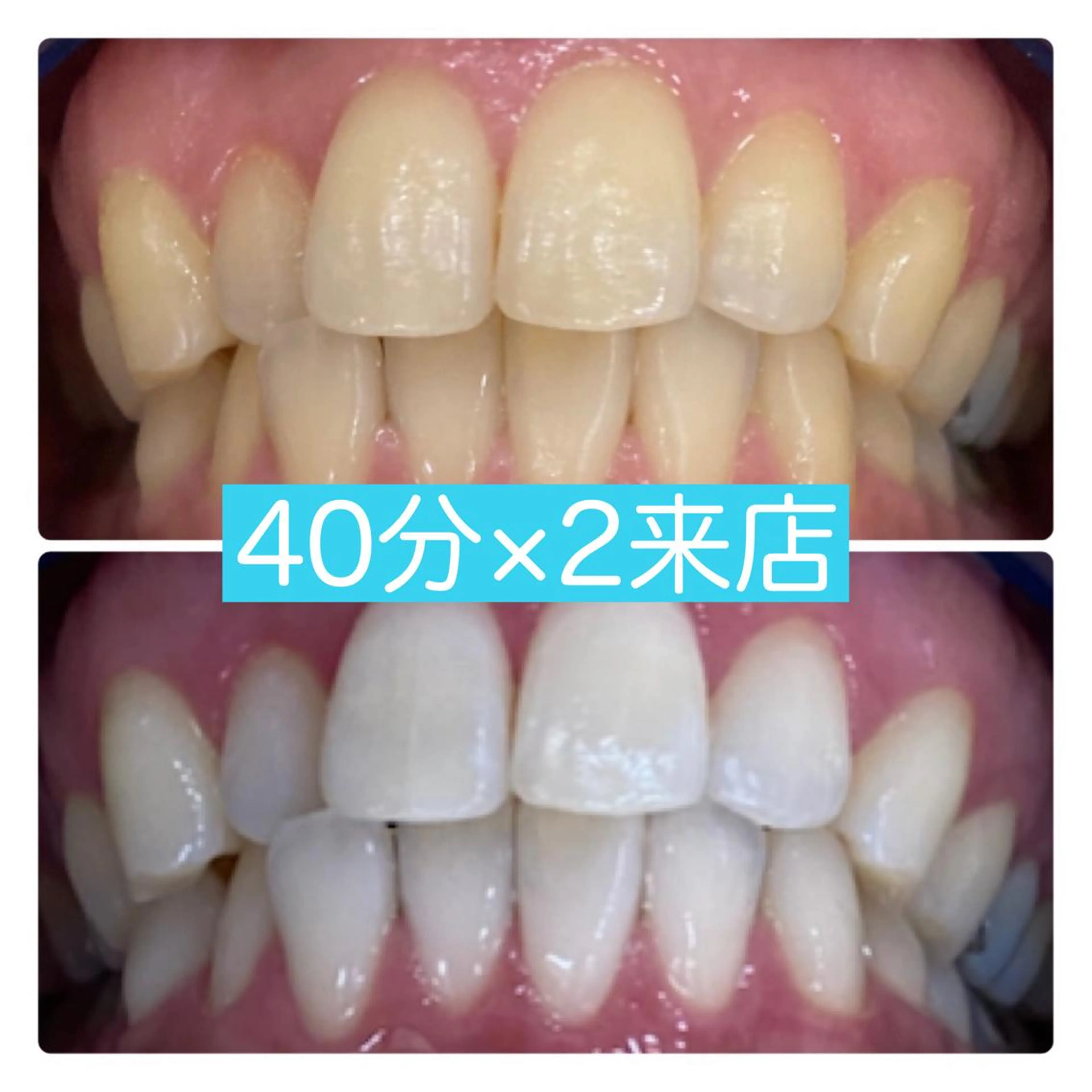 その他 PLATINUM Beauty 横浜店所属・ホワイトニングルーム 横浜店のその他イメージ