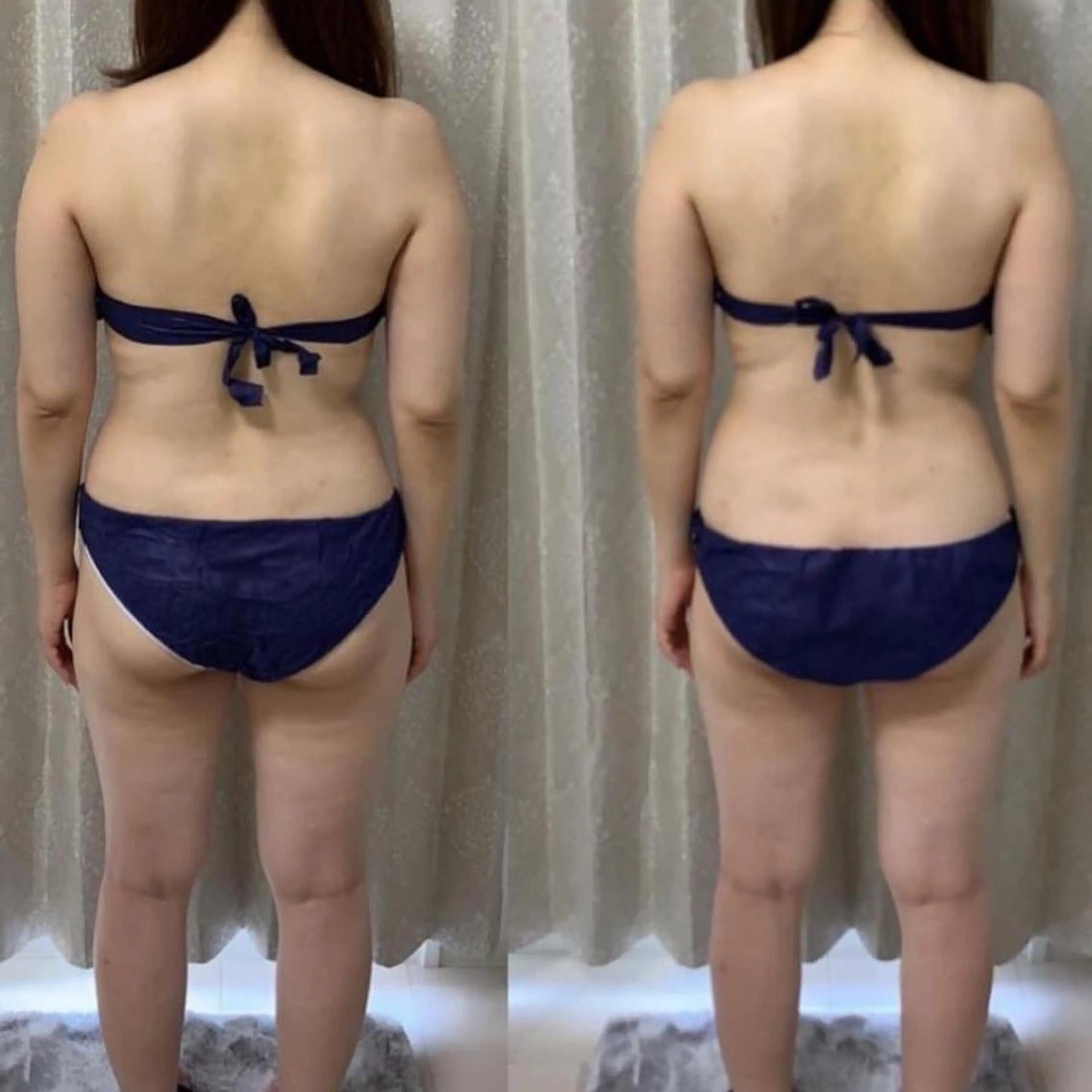 エステ リラク 長堀橋エステサロン charmignonのエステ・リラクイメージ