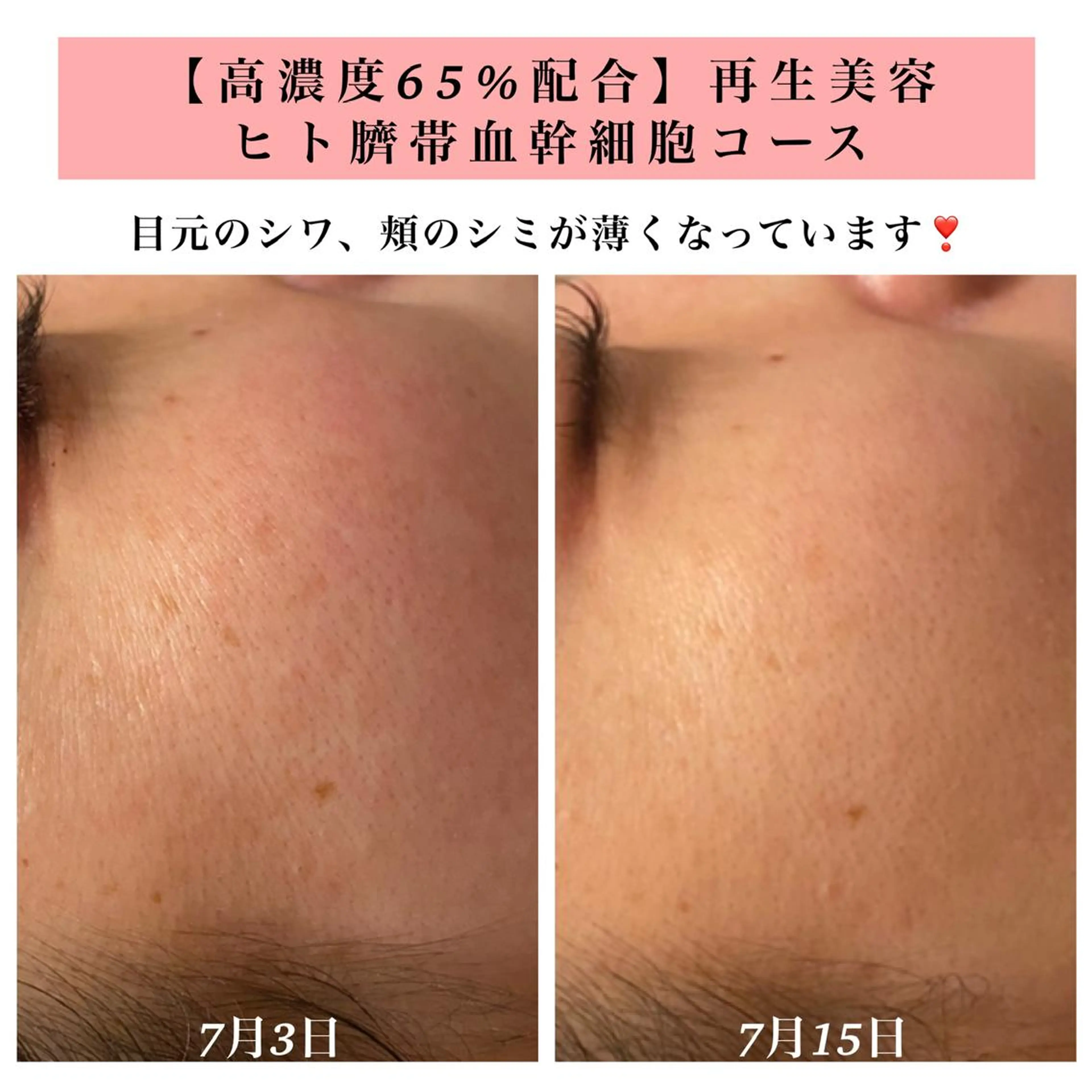 エステ リラク Bellesthe （ベルエステ）のエステ・リラクイメージ