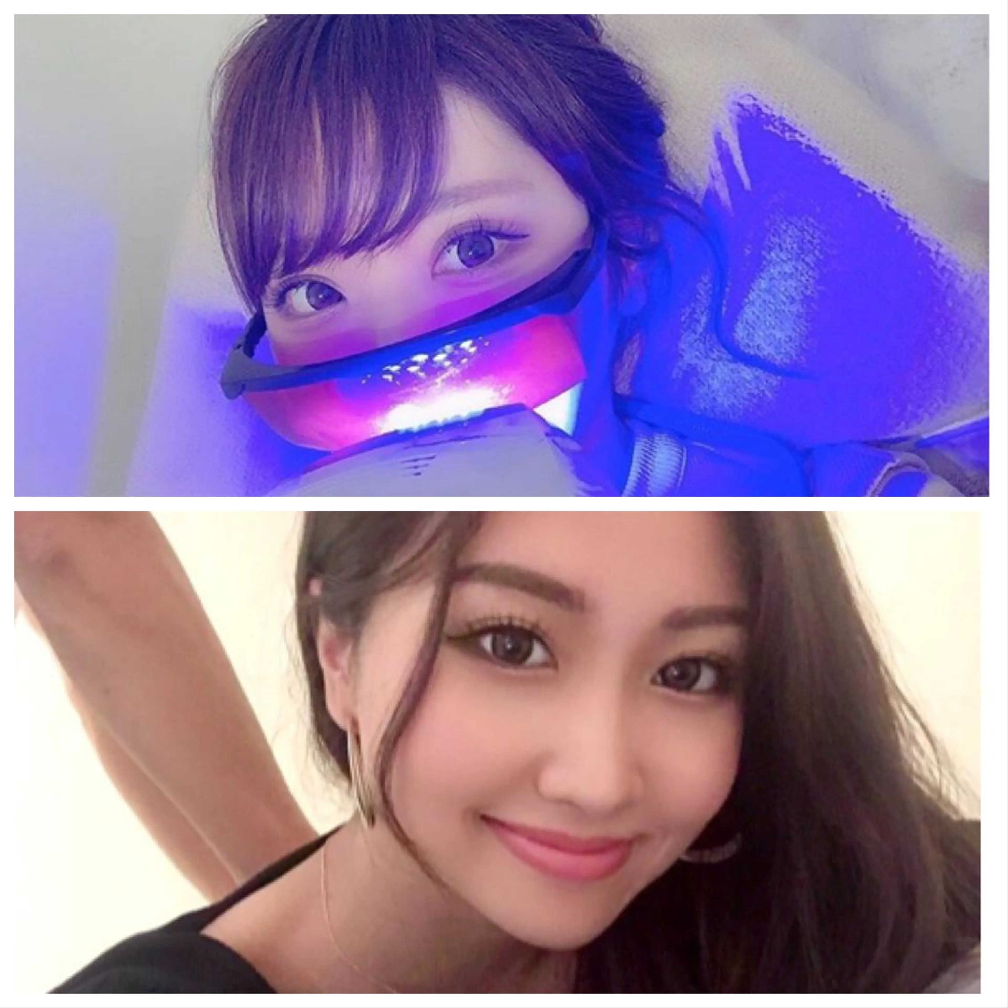 【美容整体×ホワイトニング】美容整体は身体の歪みや筋肉の凝り等をしっかり取っていきます🤗の写真