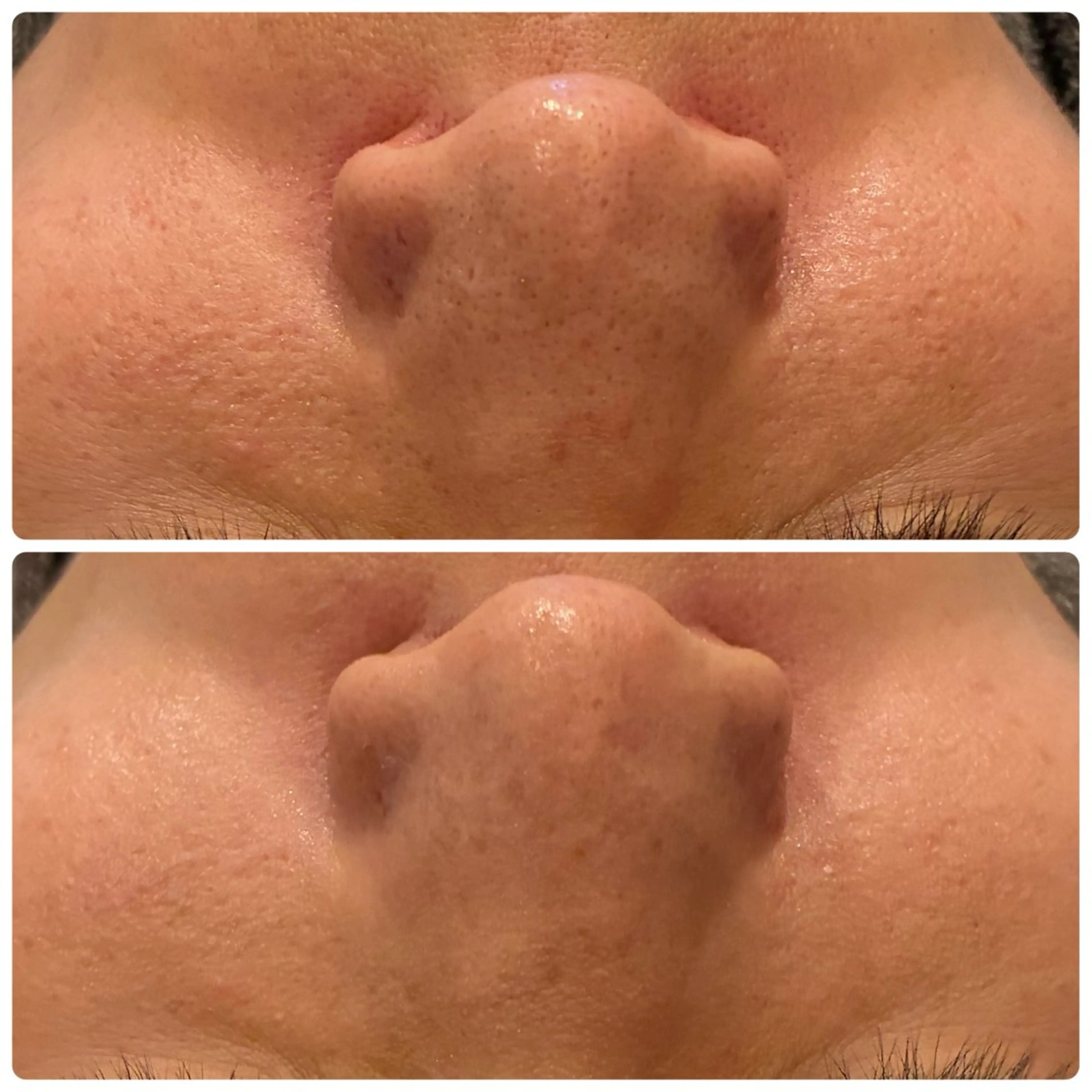 その他 yellow.所属・yellow💛【 脱毛&フェイシャル】のエステ・リラクイメージ