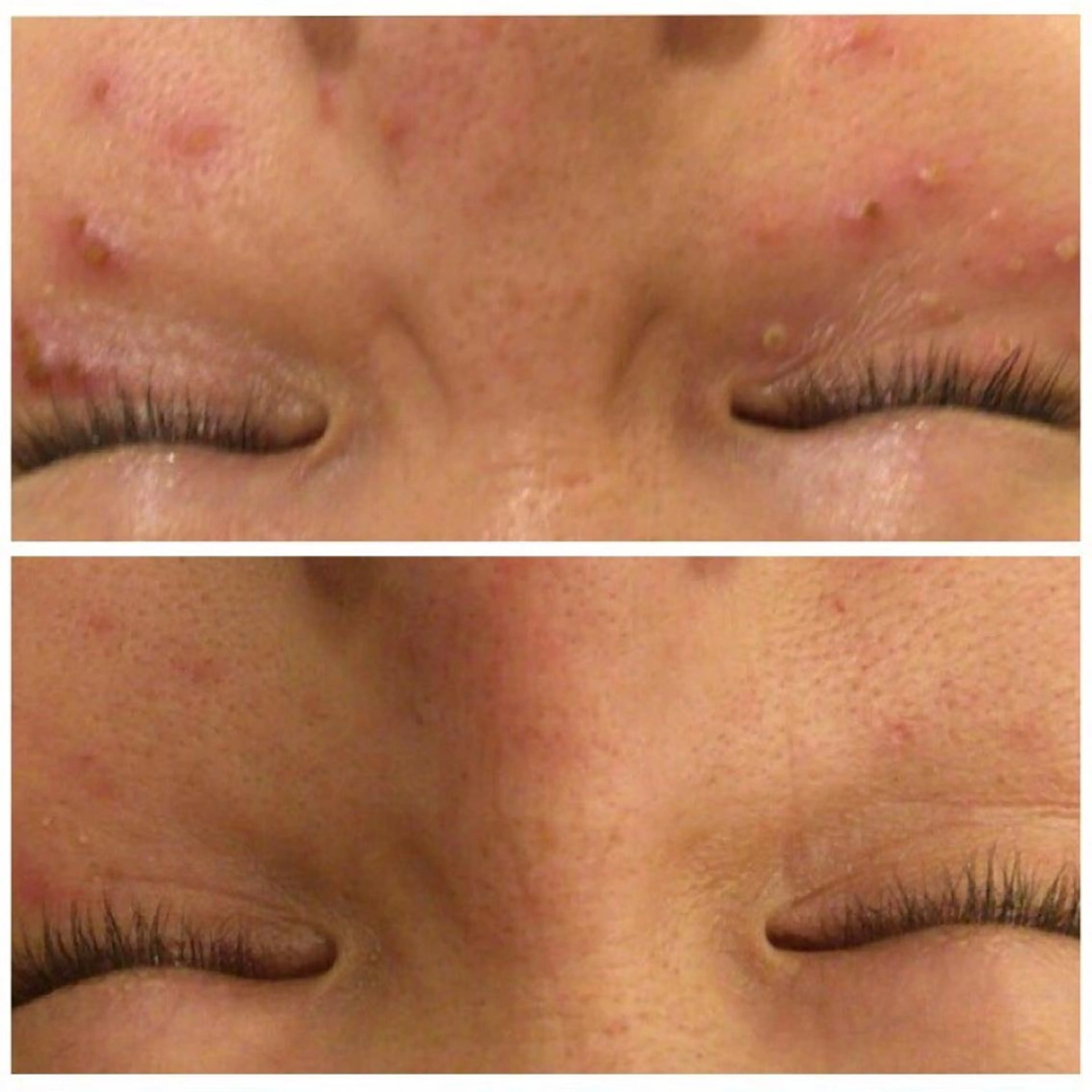 セミロング カラー パーマ ヘアアレンジ メンズ キッズ ネイル マツエク・マツパ アイブロウ ニキビ特化型エステ 🍓最短で肌質改善のエステ・リラクイメージ