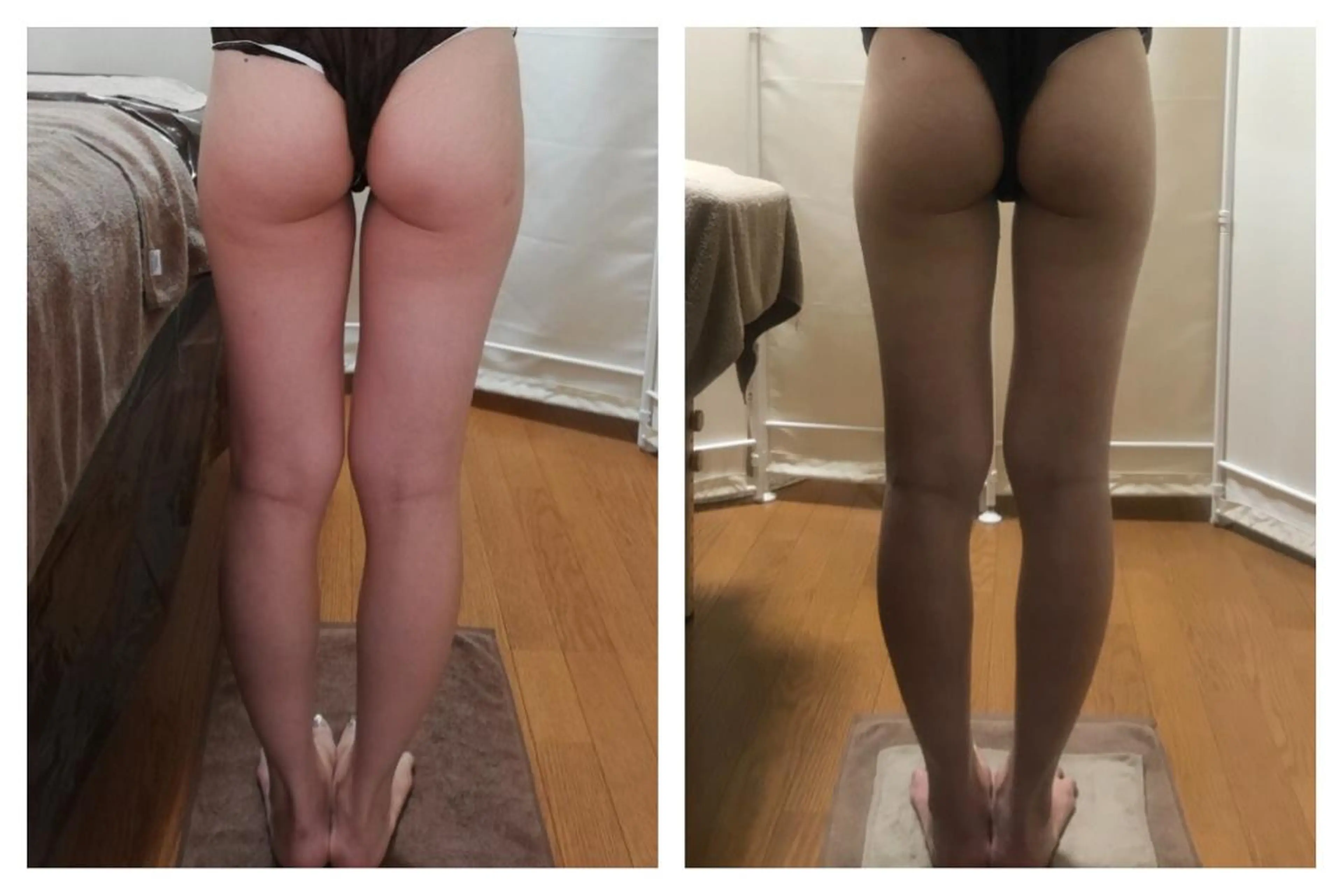 biloop所属・《痩身×疲労改善》 BILOOPのエステ・リラクイメージ