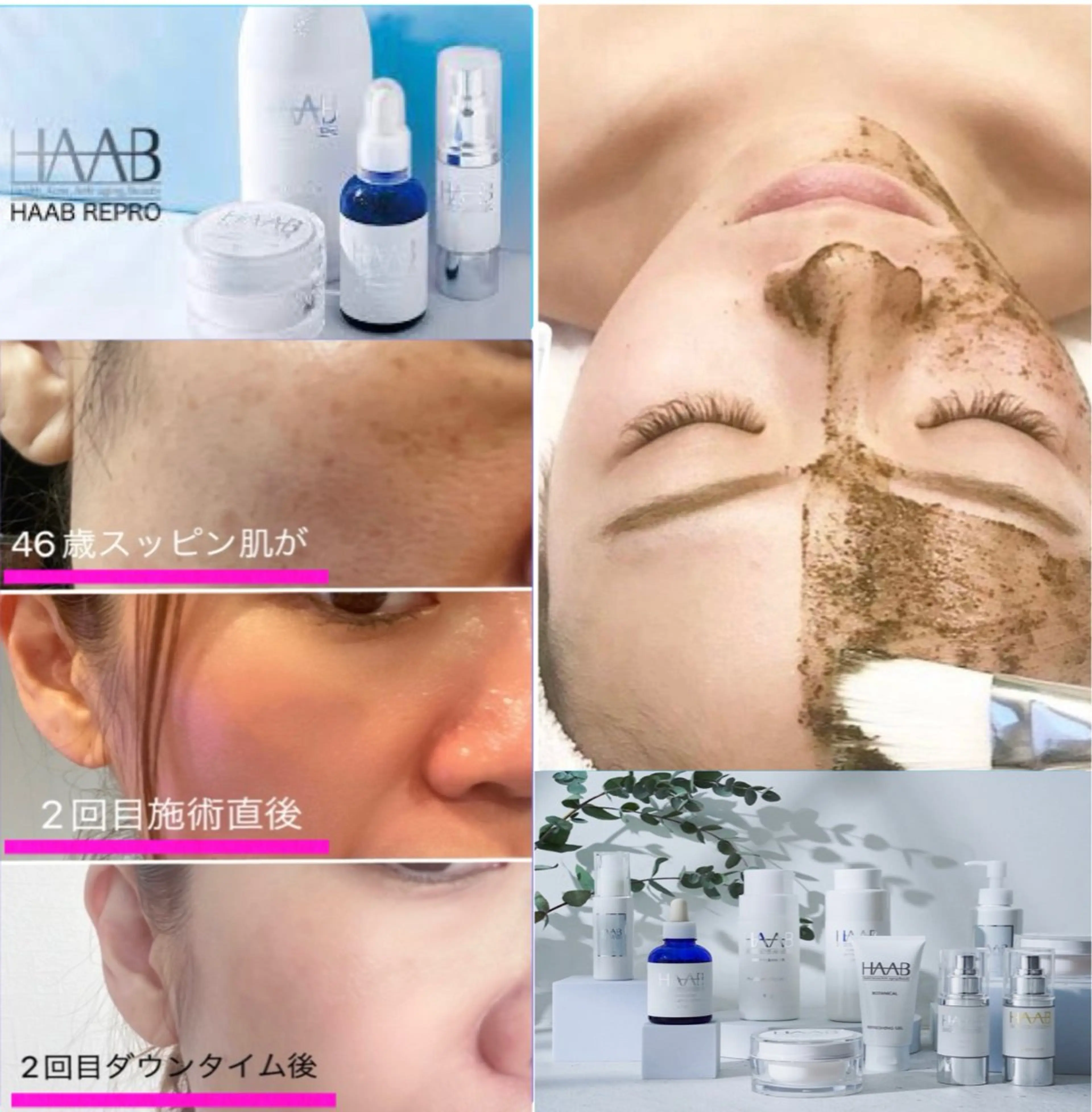 痩身ダイエット&小顔専門店Rs slim（アールズスリム）所属・痩身ダイエット&小顔 🩷アールズスリムのエステ・リラクイメージ