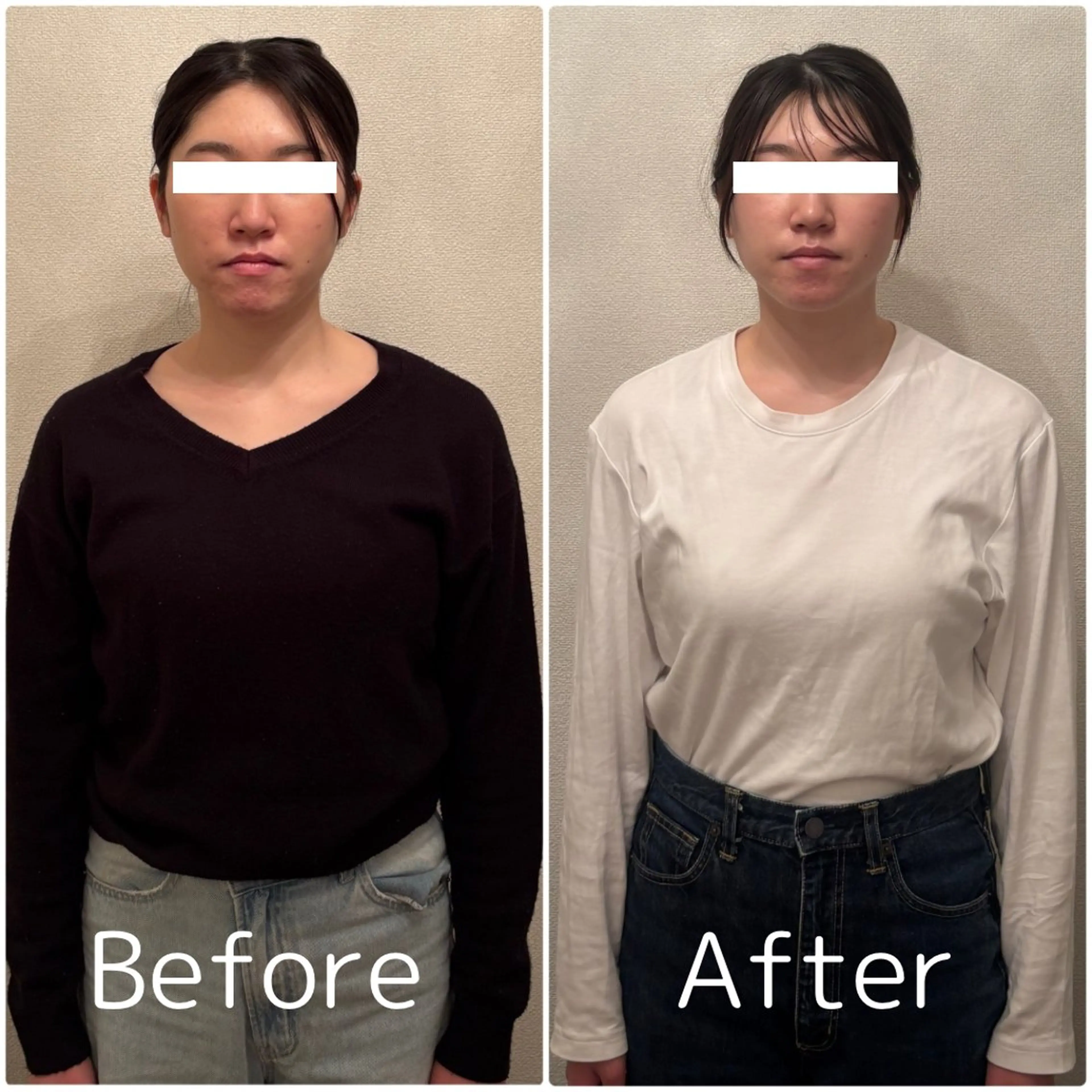 Lily luce 美骨小顔矯正のその他イメージ