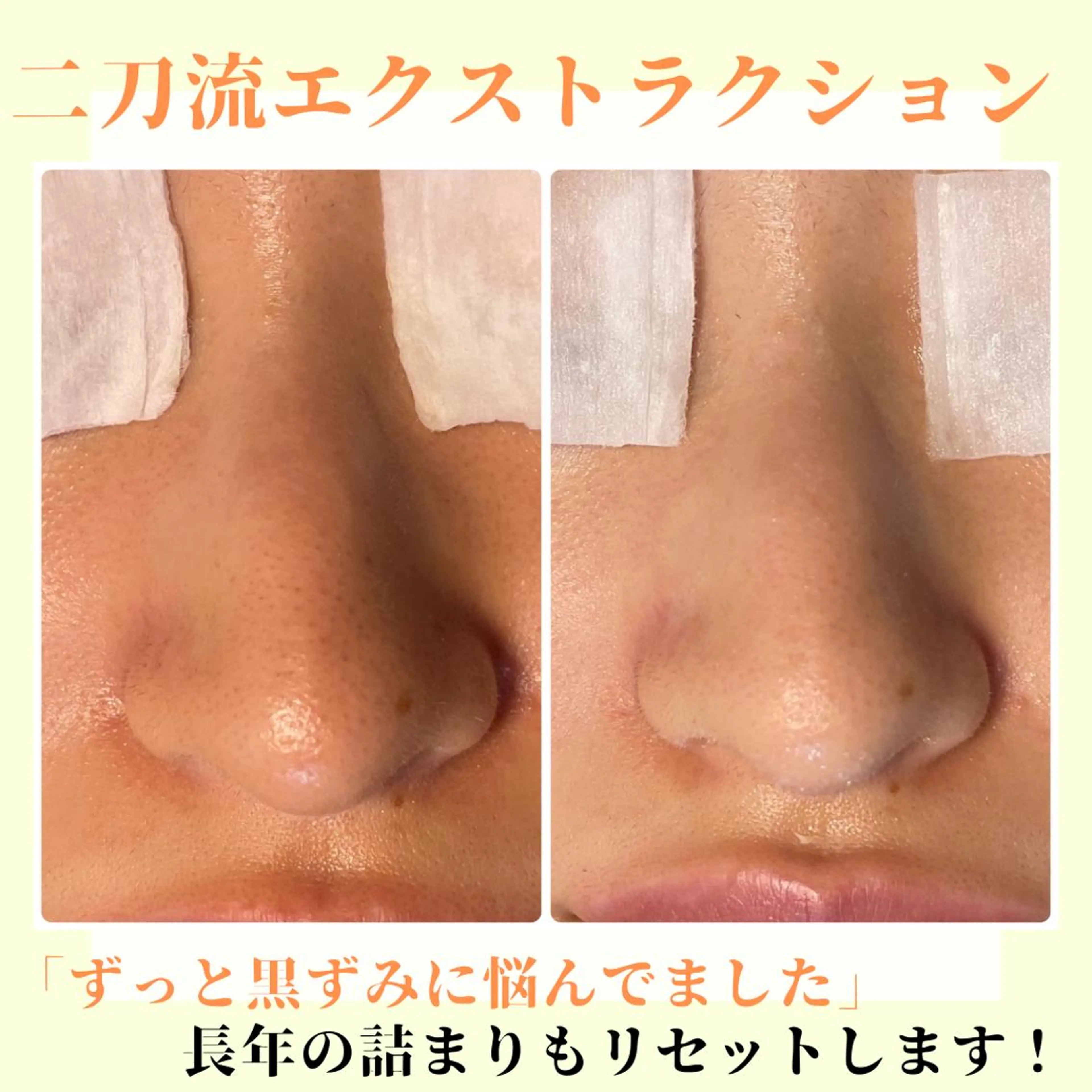 ピーリング専門店 Belluteのエステ・リラクイメージ