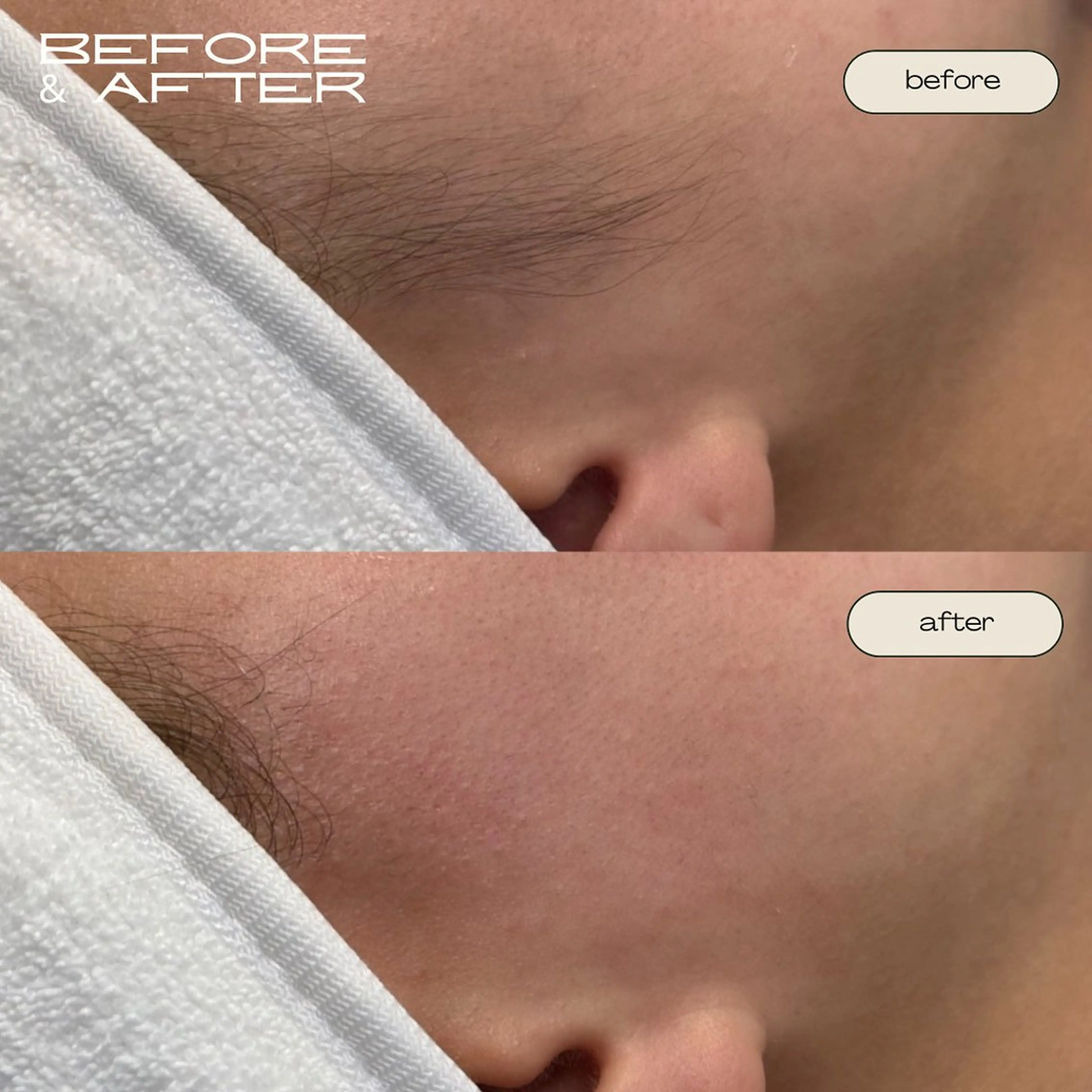 エステ BeautySalon moze所属・moze 對島のエステ・リラクイメージ