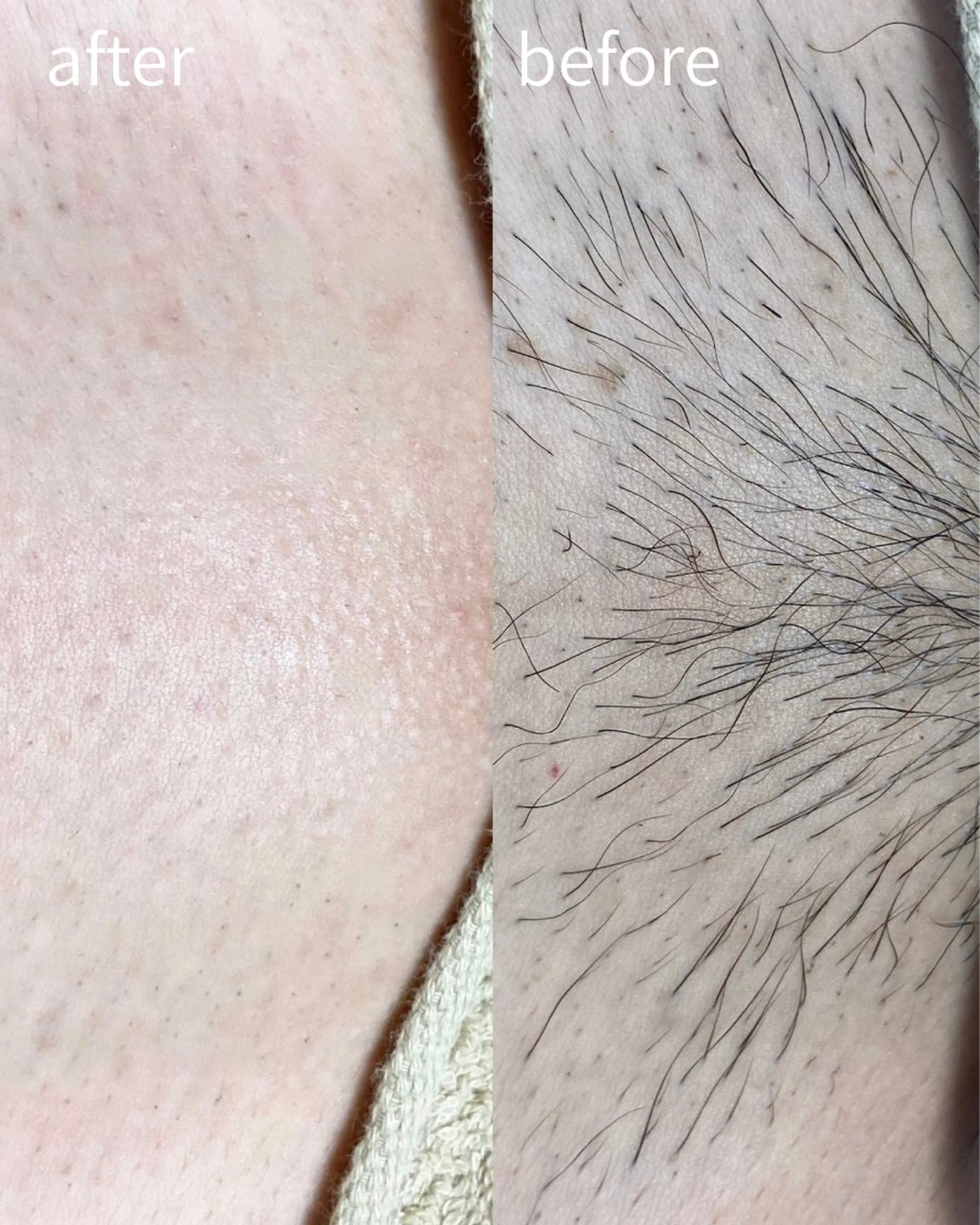 脱毛 &me ayakaのエステ・リラクイメージ