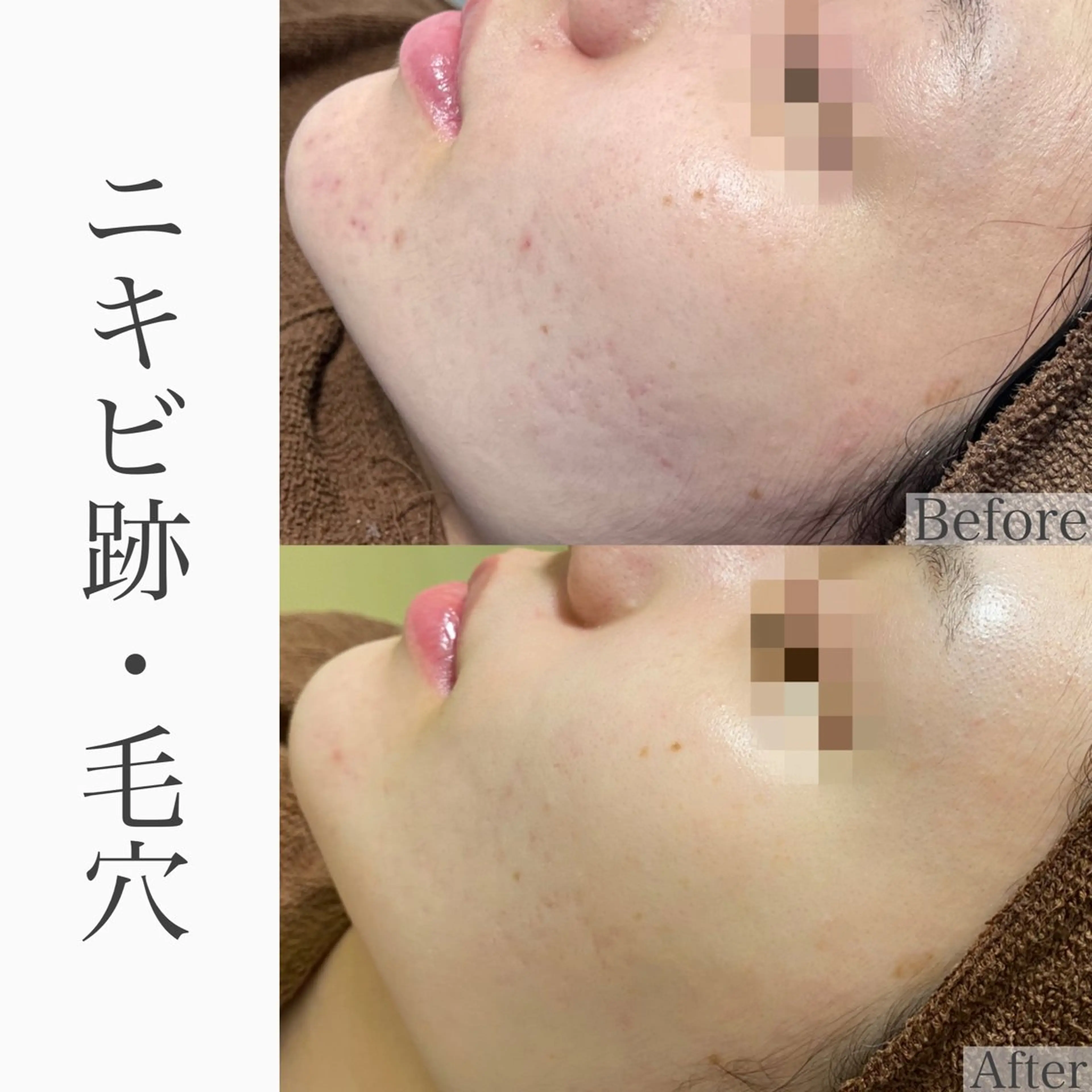 ハーブピーリング専門 BIOEL横浜のエステ・リラクイメージ