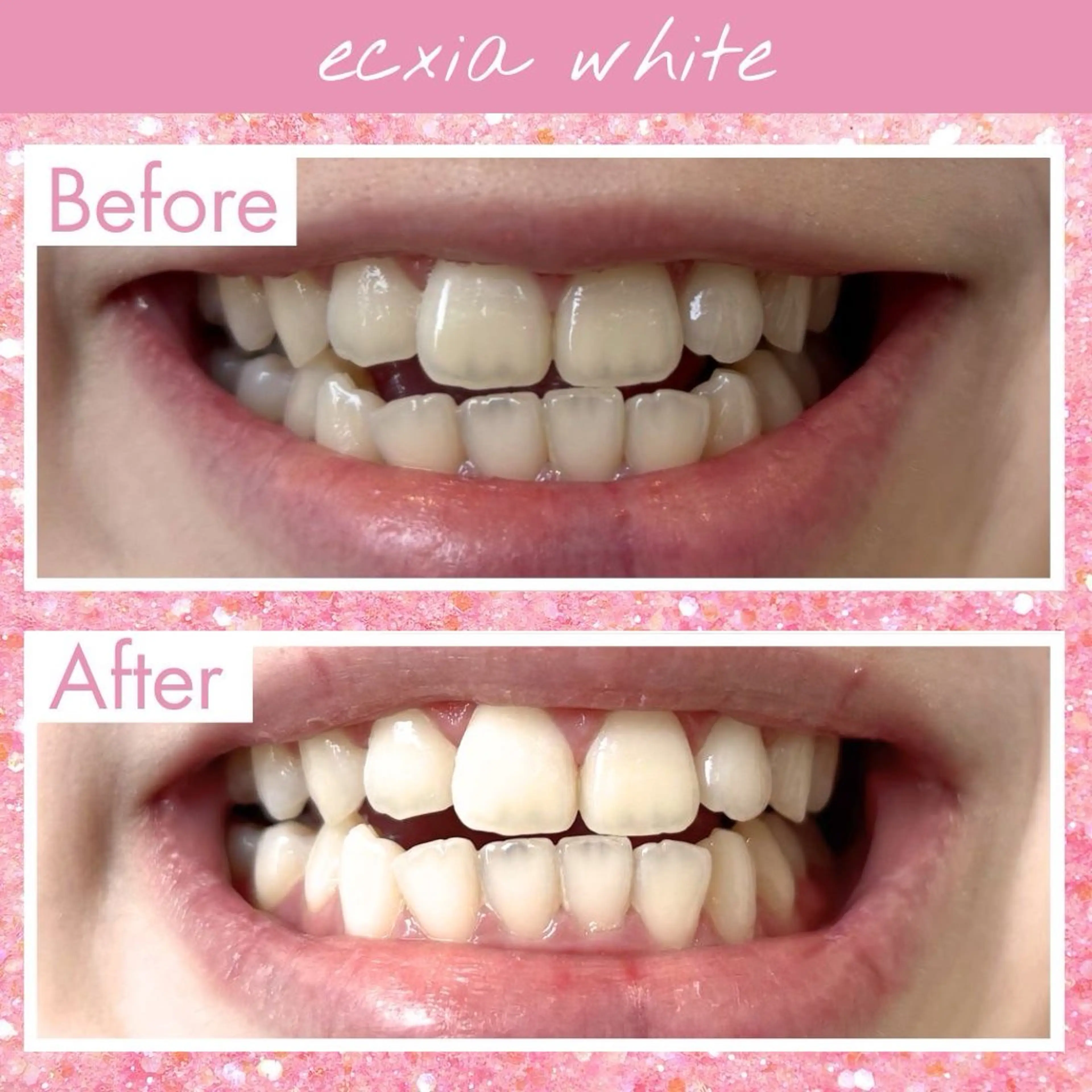 エクシア仙台駅東口店所属・セルフホワイトニング エクシア仙台駅東口店のその他イメージ