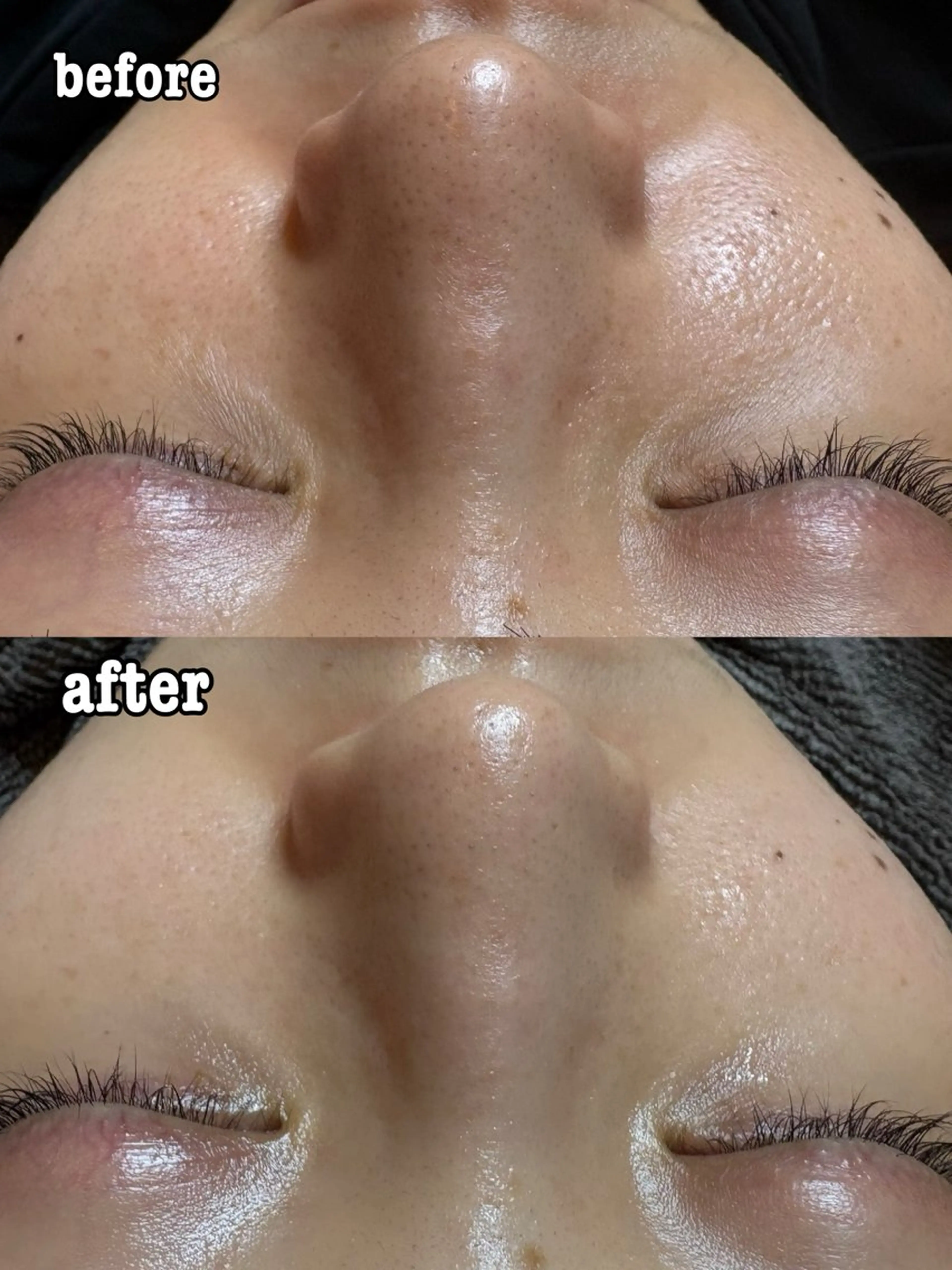 Minnat所属・小林 里菜のエステ・リラクイメージ