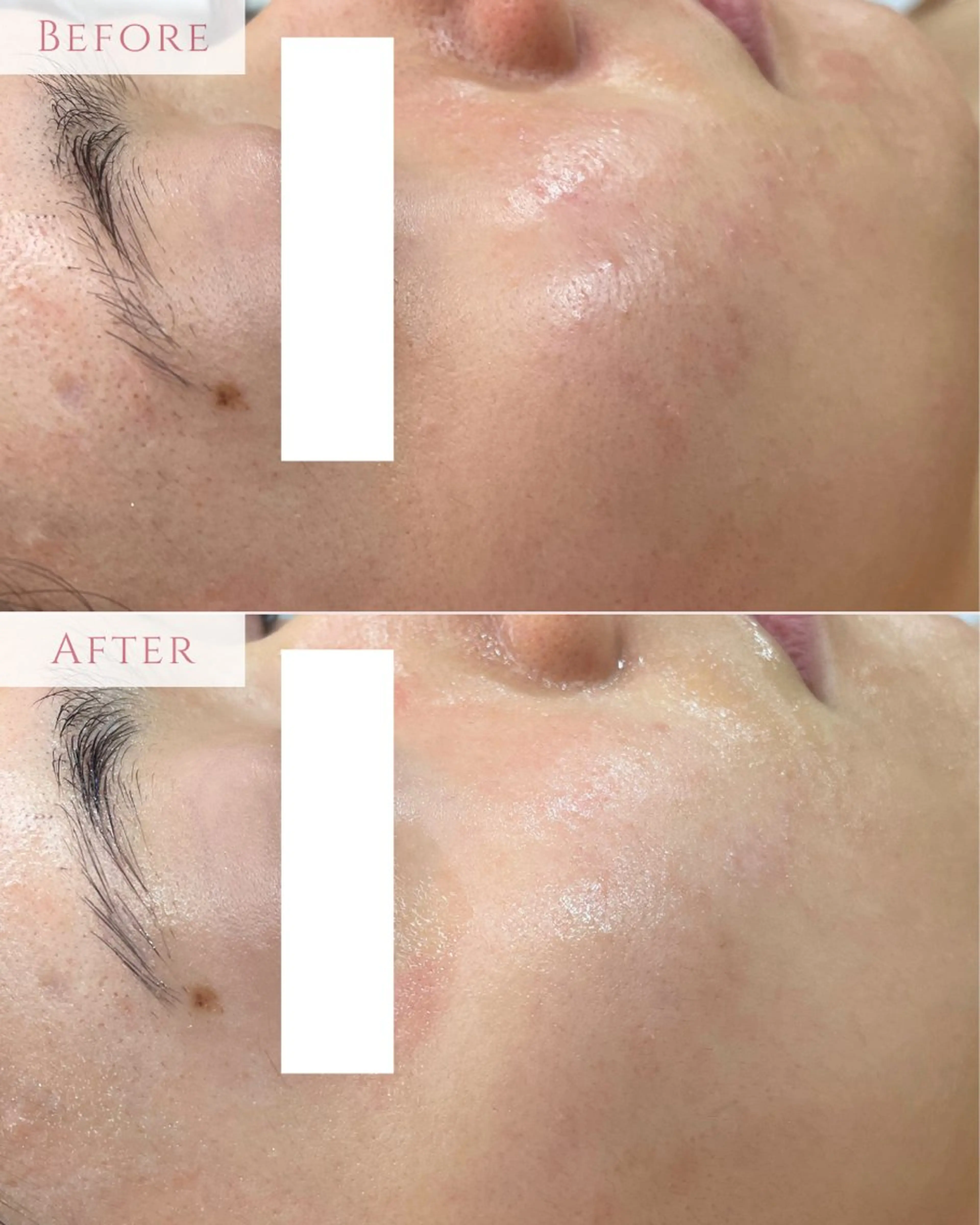 エステ 肌質改善専門サロン Bellmi/心斎橋のエステ・リラクイメージ