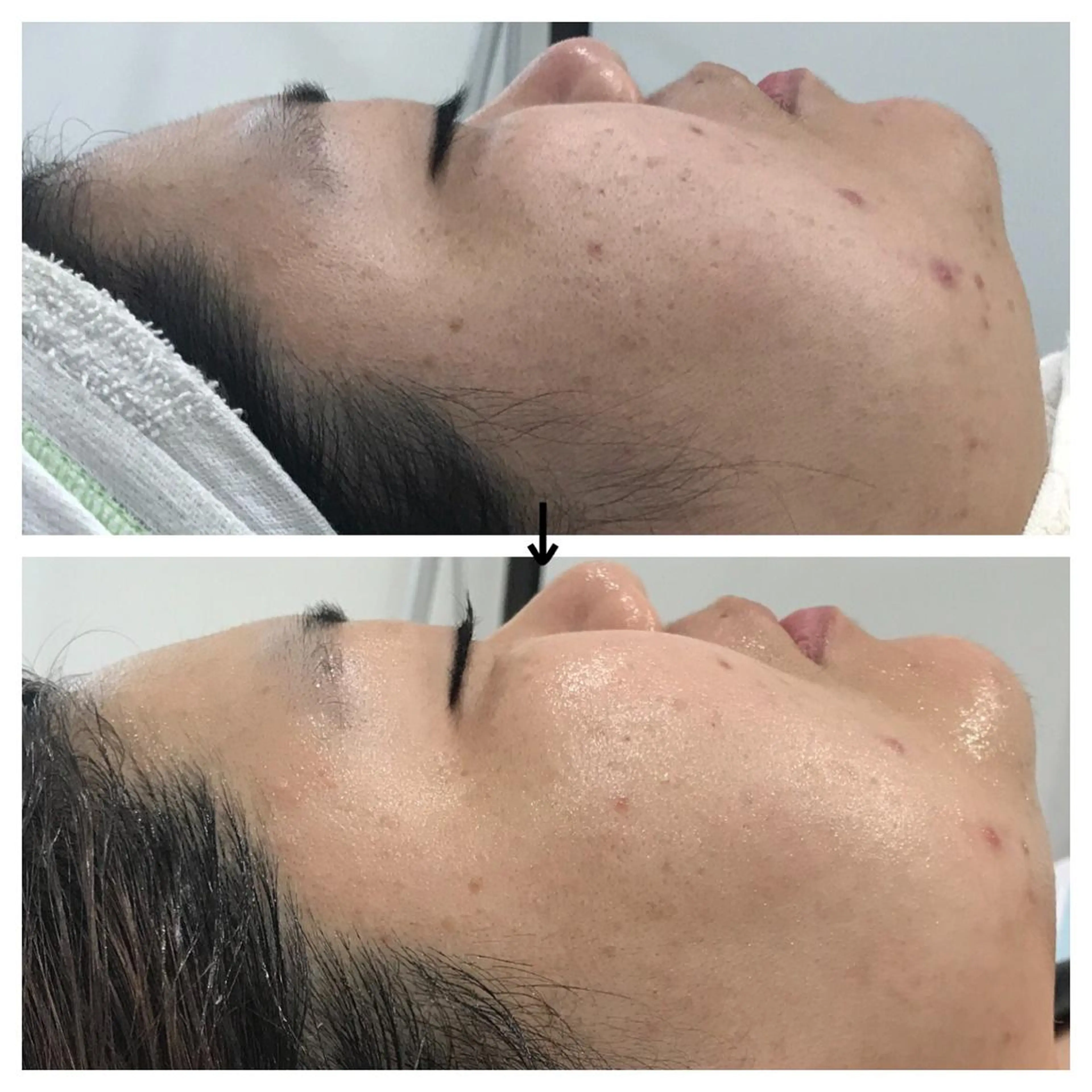 ビューティー ミロワールのエステ・リラクイメージ