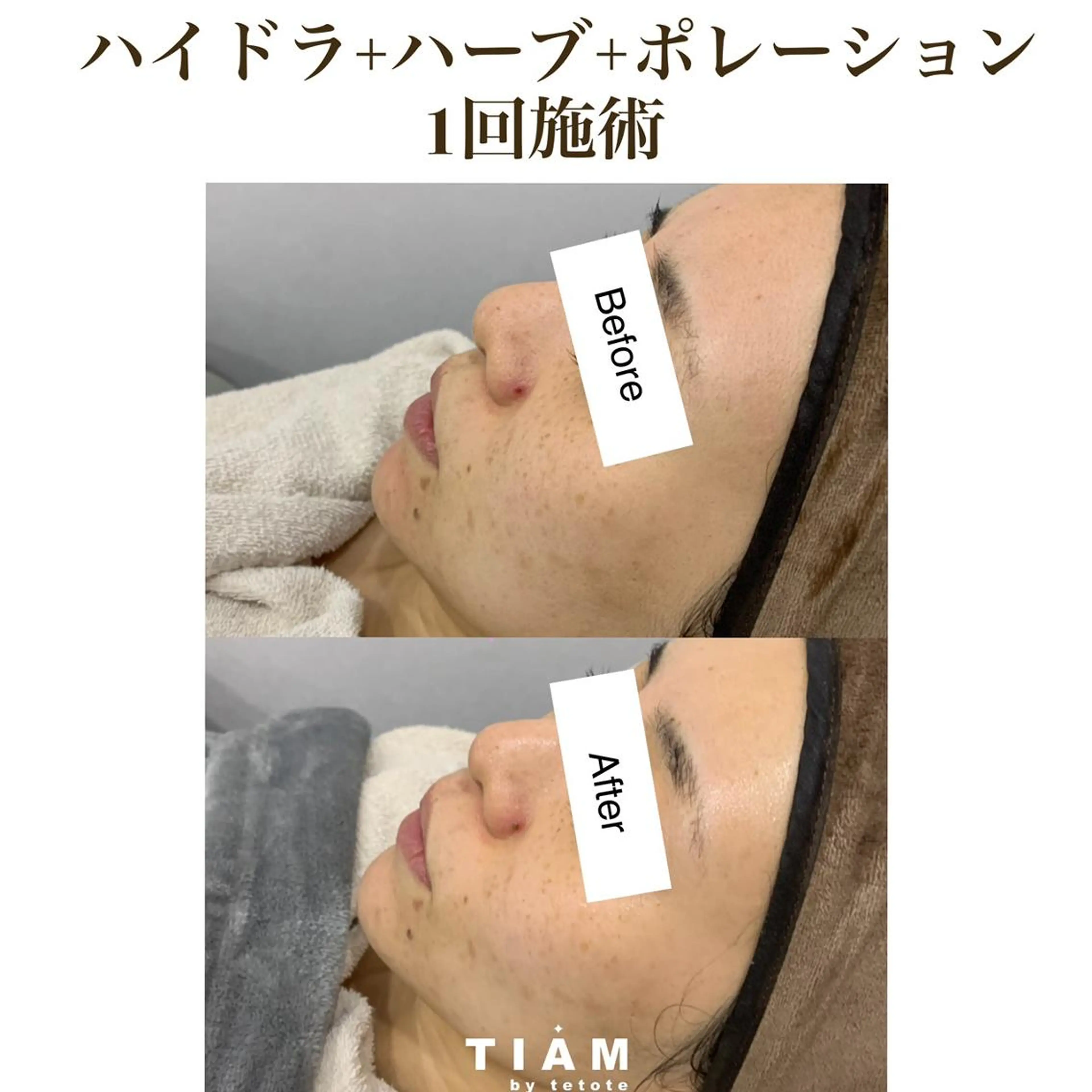 美肌サロンTIAM by tetoteのエステ・リラクイメージ