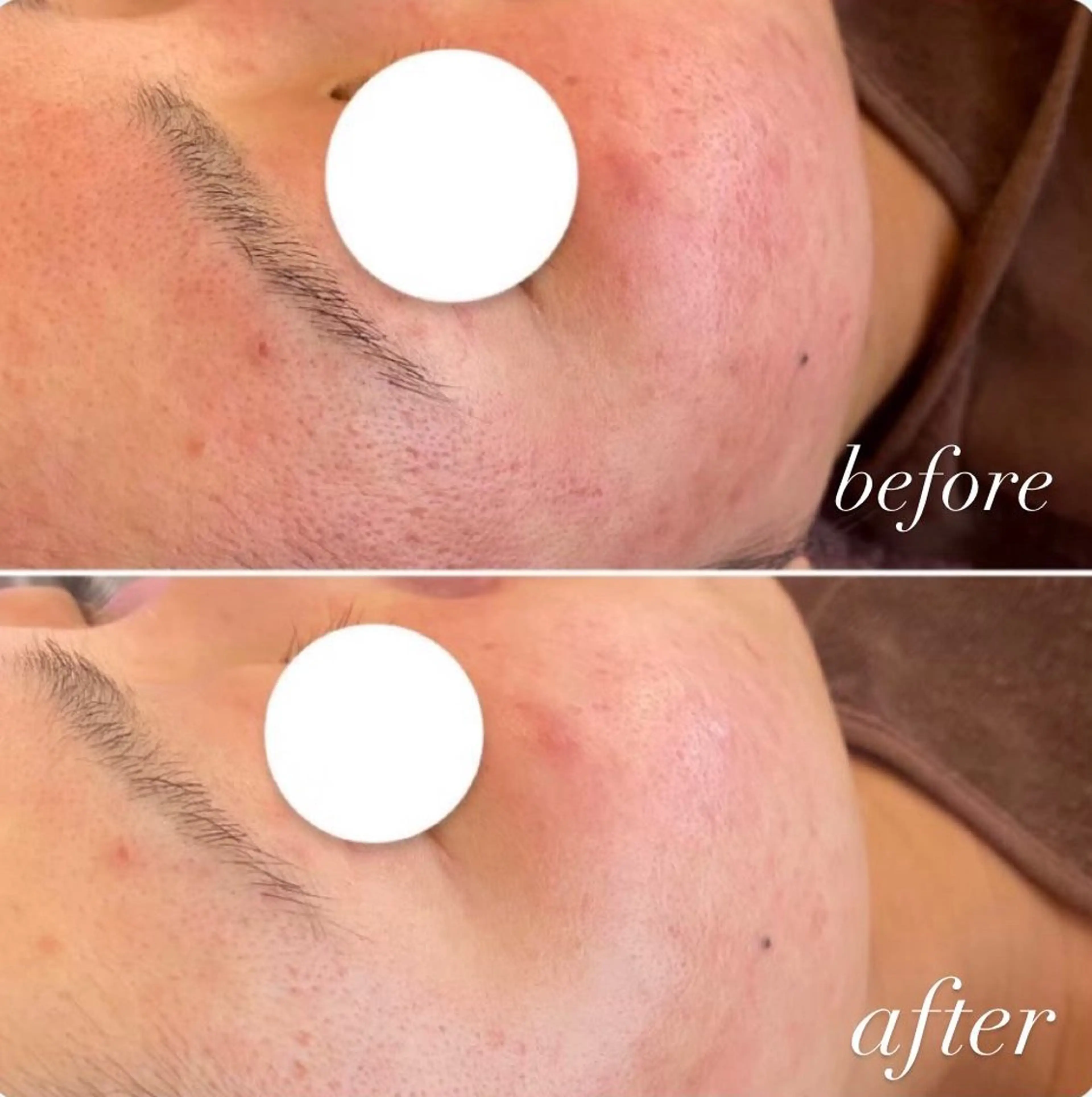 【頭痛、睡眠改善】 salon RUUのエステ・リラクイメージ