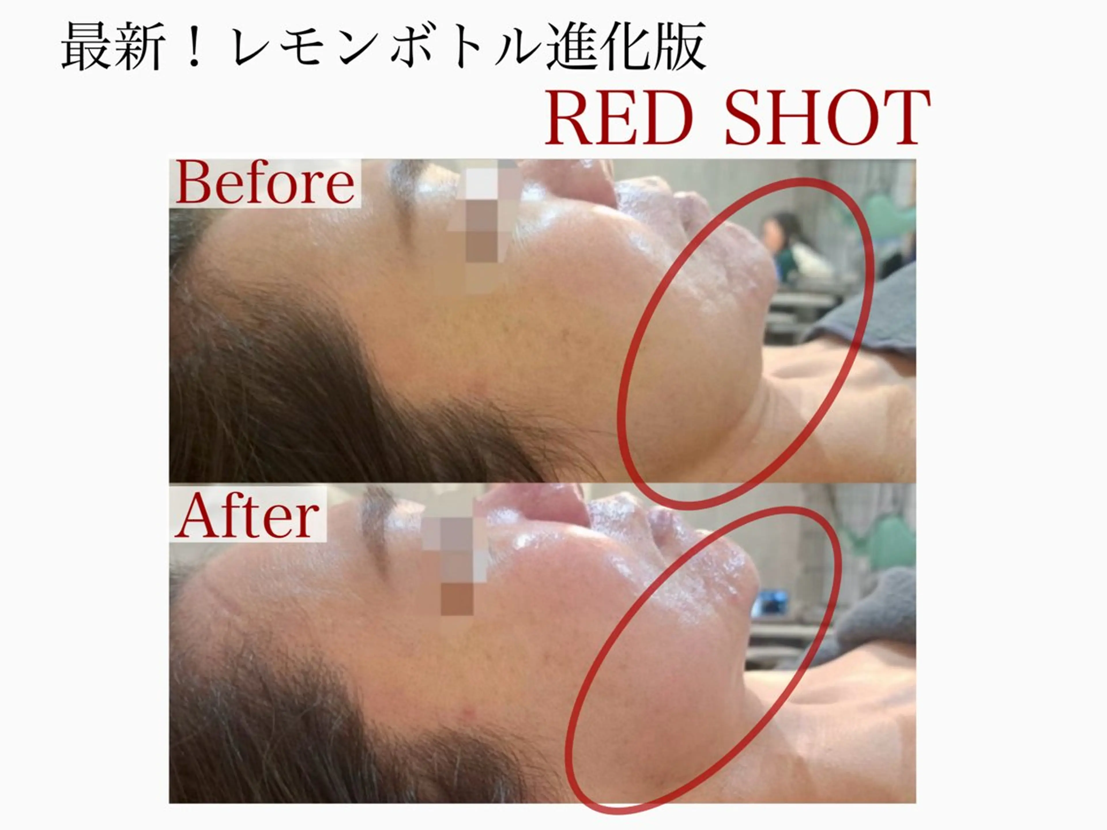 エステ 🌸🧡六本木 脱毛しずか🧡🫧の眉毛・アイブロウイメージ