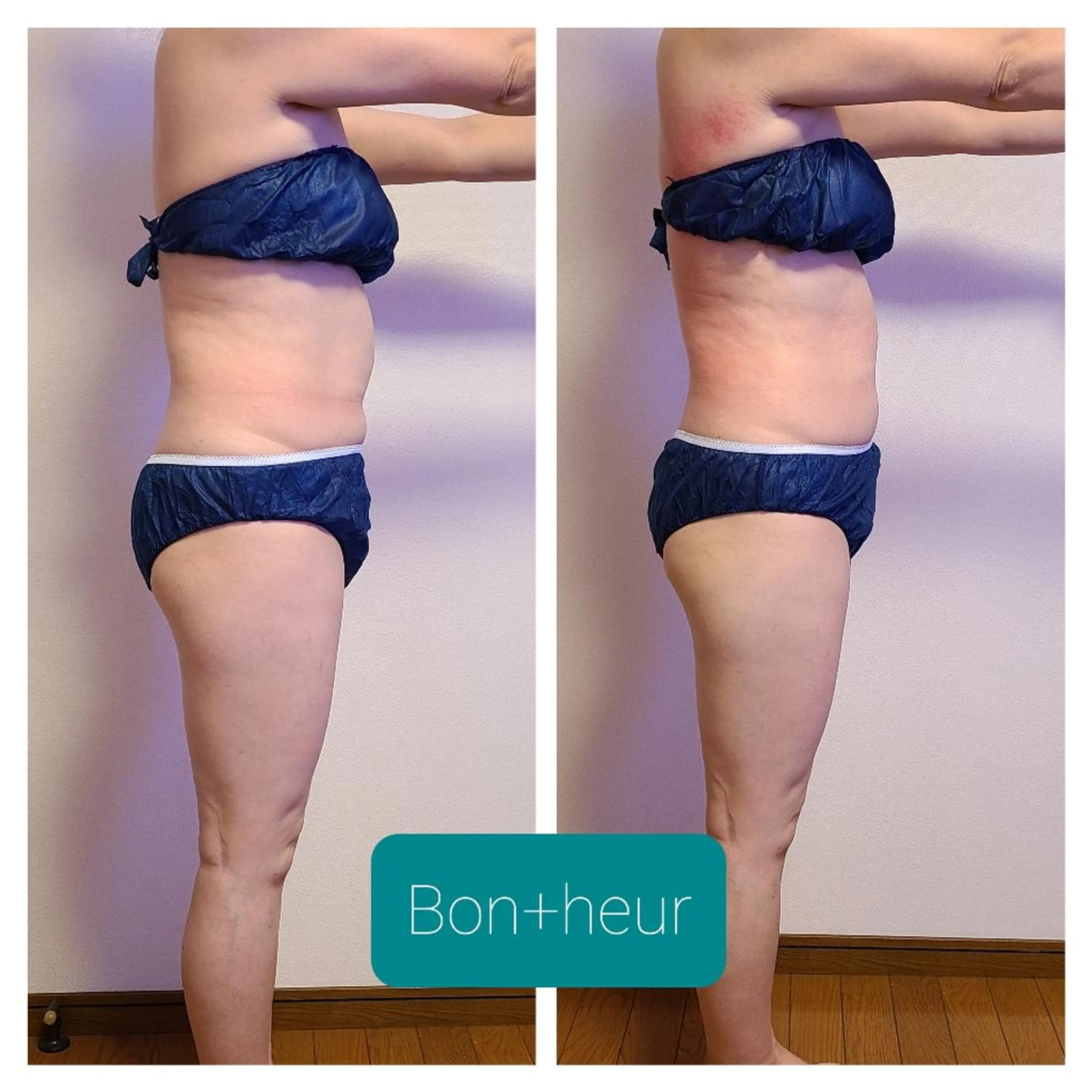 エステ 宮口 紗子のネイルデザイン