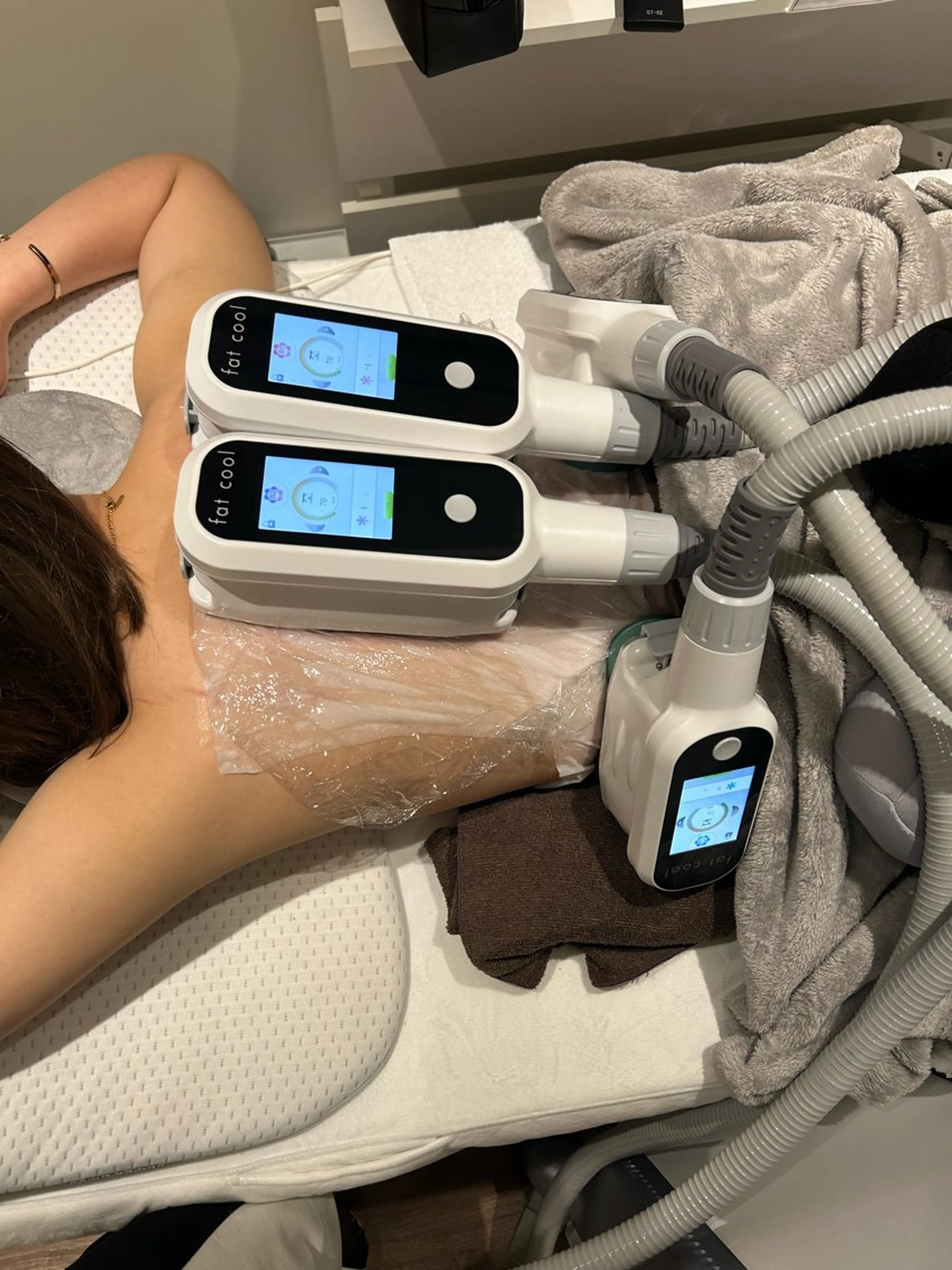 脂肪痩身〈背中〉初回体験2カップの写真