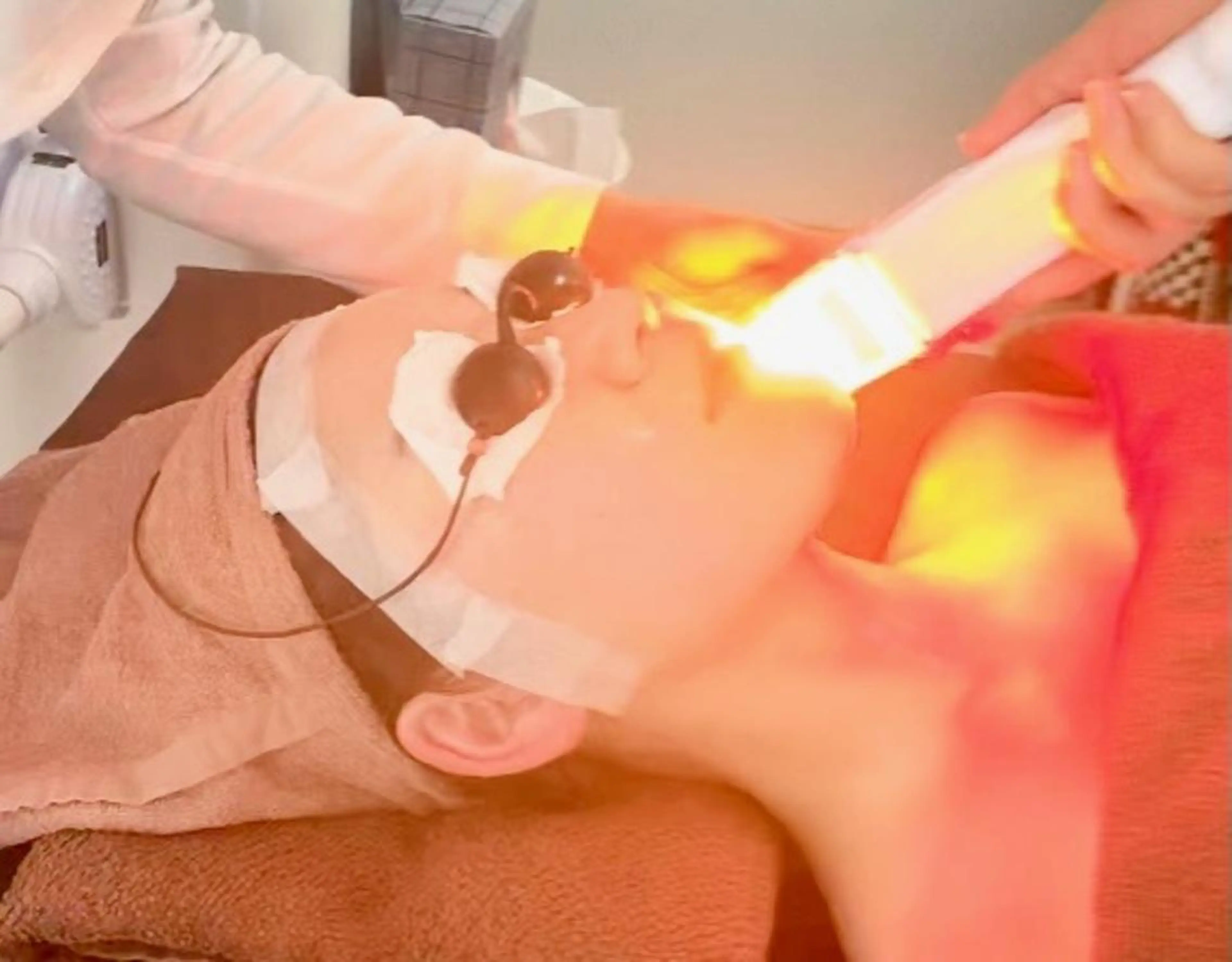 【体験】BBL光フェイシャル(パック付き) 初回カウンセリング込みの写真