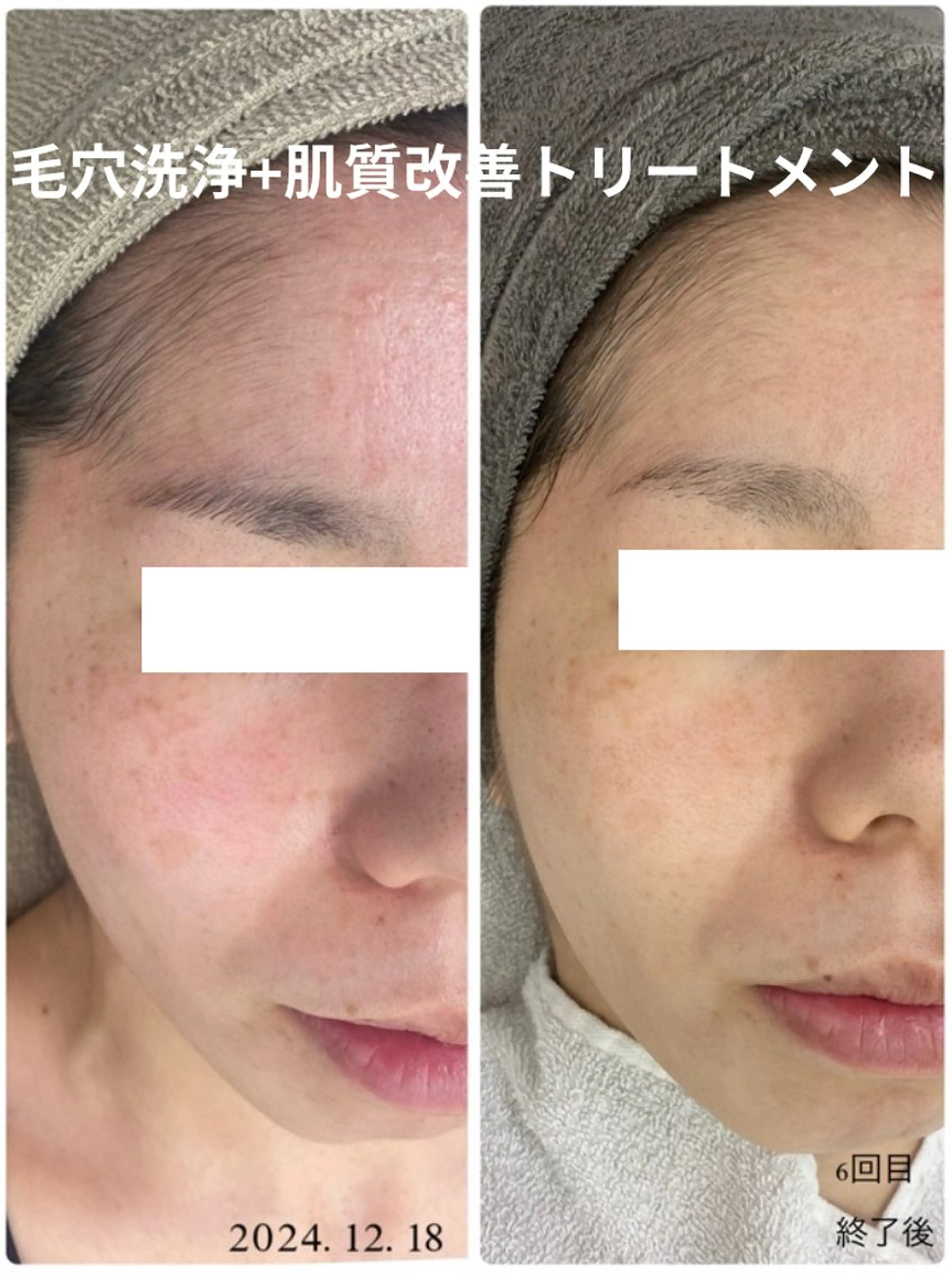 メンズ クリニカルWHITEケア豊見城所属・えだ すがこのエステ・リラクイメージ