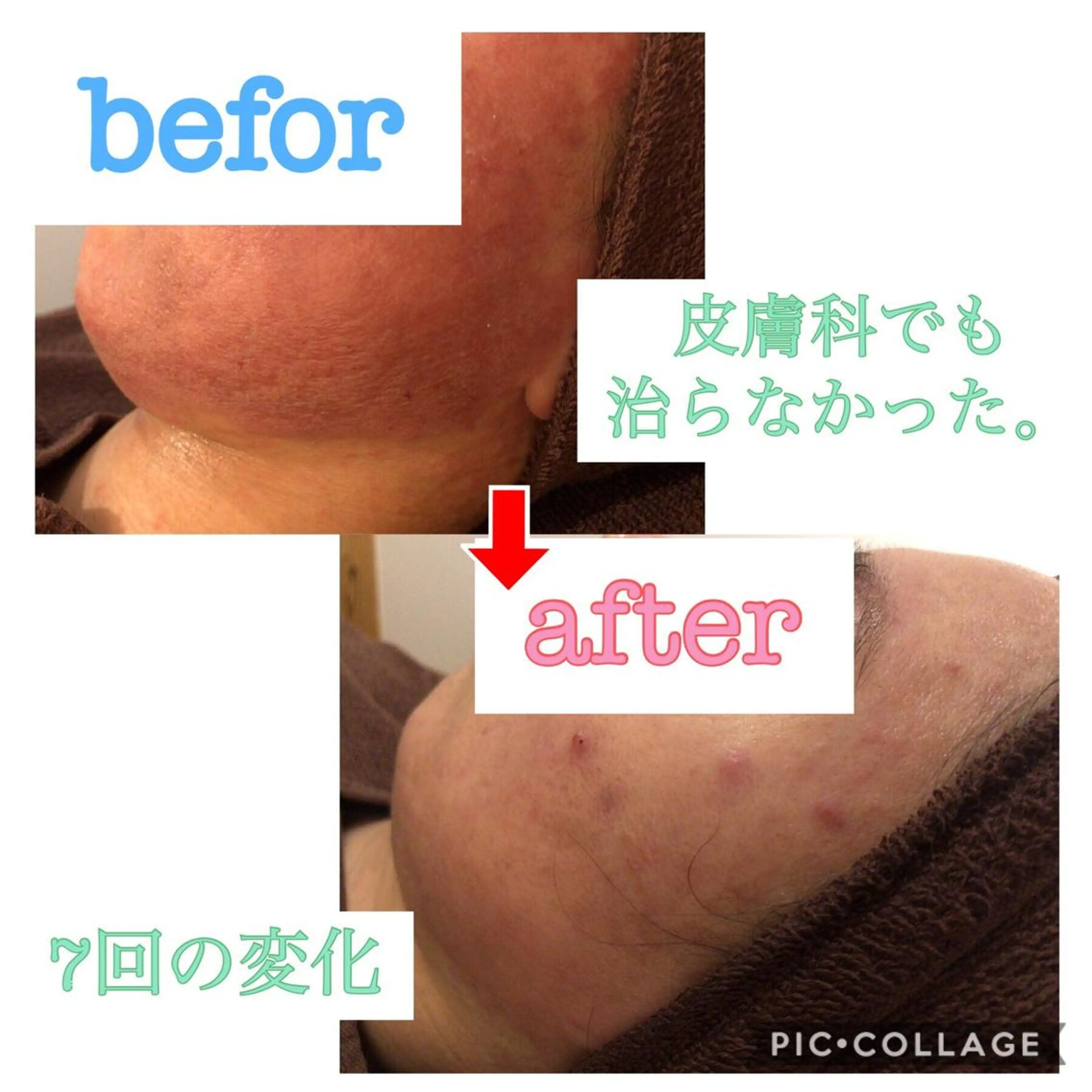 ショート カラー パーマ ヘアアレンジ メンズ キッズ ネイル マツエク・マツパ 四つ星サロン🎖 腸＆ニキビケアに特化のエステ・リラクイメージ