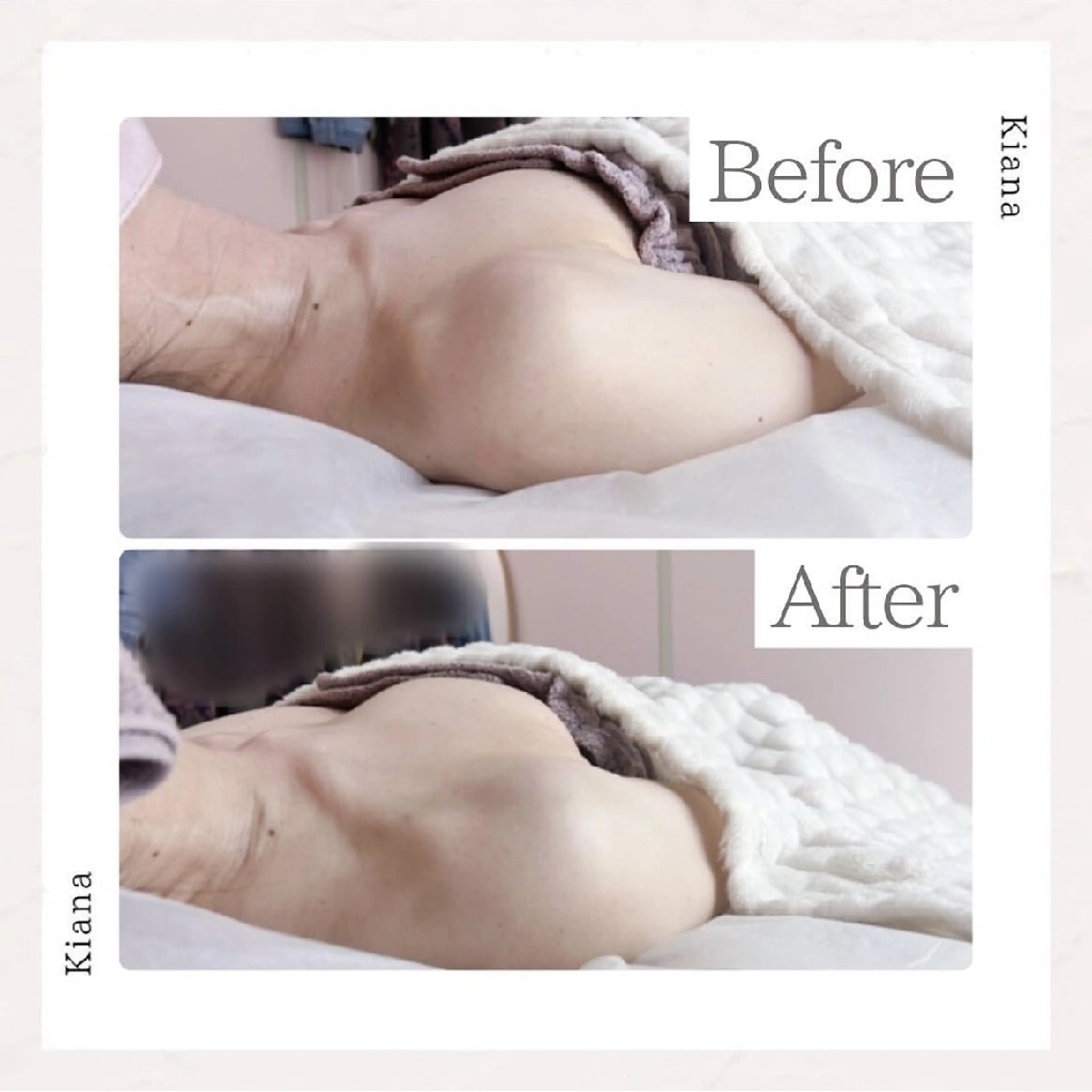 エステ リラク 【バスト専門店 】 Kiana のエステ・リラクイメージ