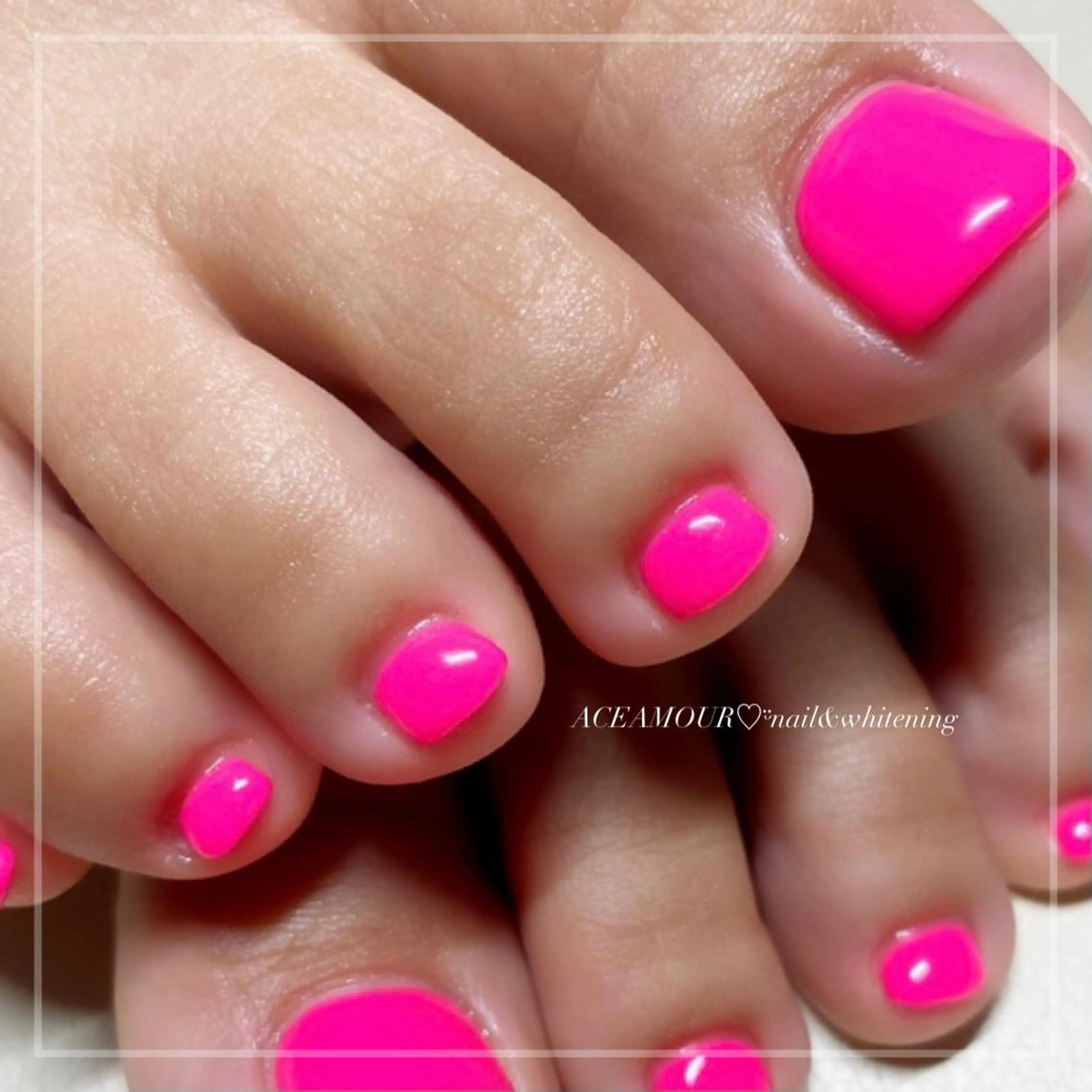 ネイル ネイル/耳つぼ /新ホワイトニングのネイルデザイン