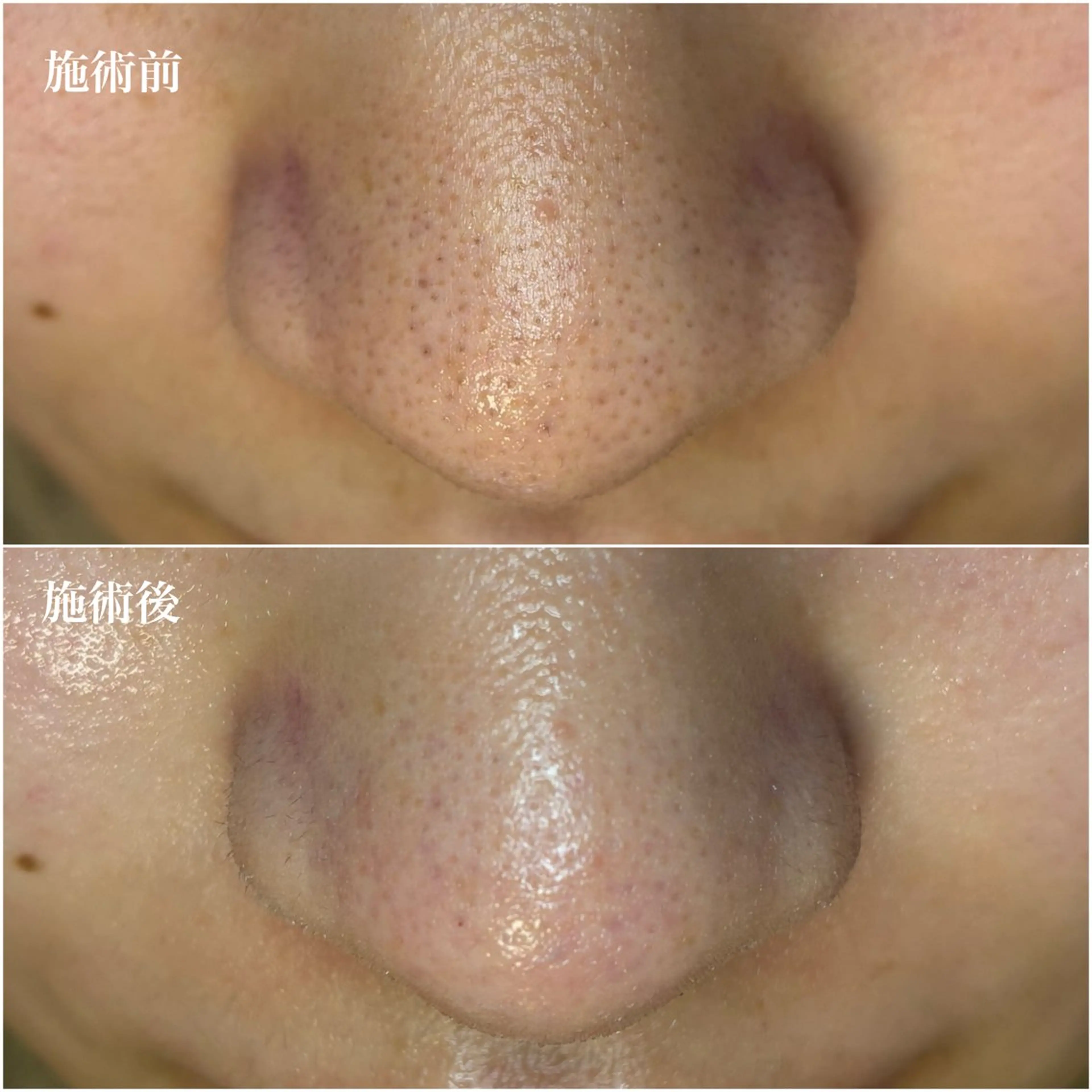 エステ リラク 毛穴専門店アイミュー mamiのエステ・リラクイメージ