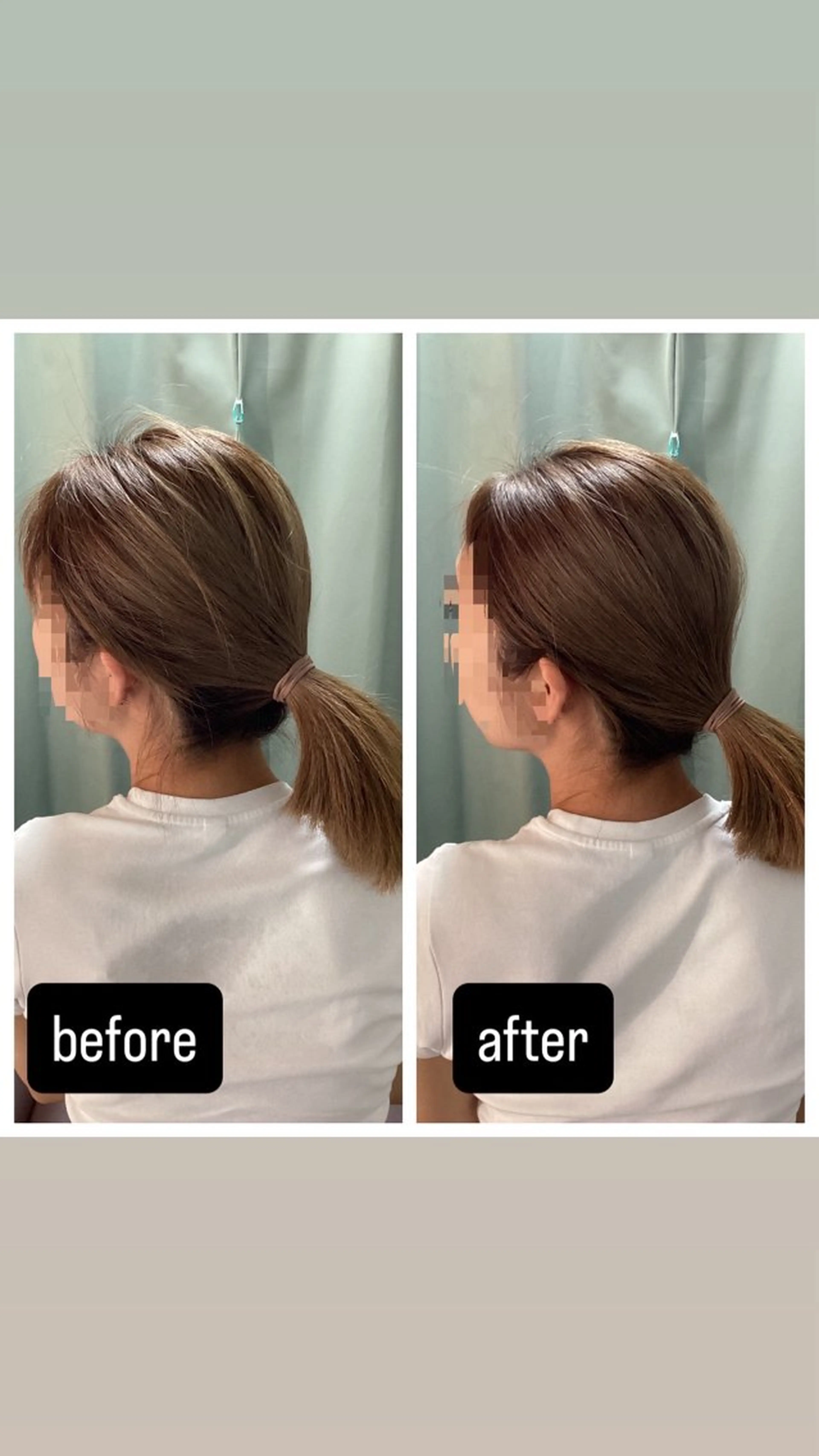 リラク すずらん鍼灸整体院 首肩こり/腰痛/整体のエステ・リラクイメージ