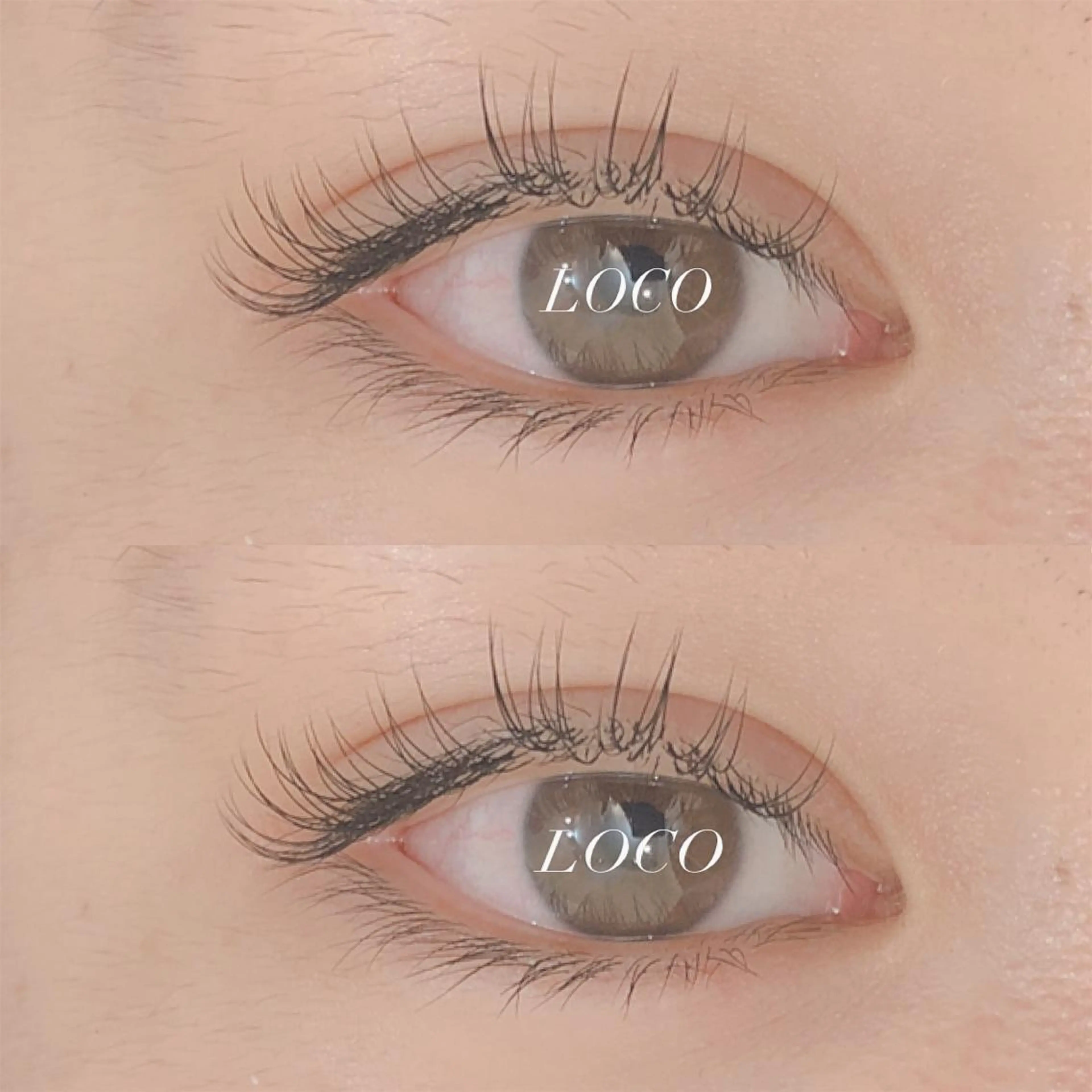 ðã»ãŒãã«ðäžïŒïŒïŒæ¬ã€ãæŸé¡âãªã çŸå®¹æ¶²ã³ãŒãã£ã³ã°ç¡æâ£ïžã®åç