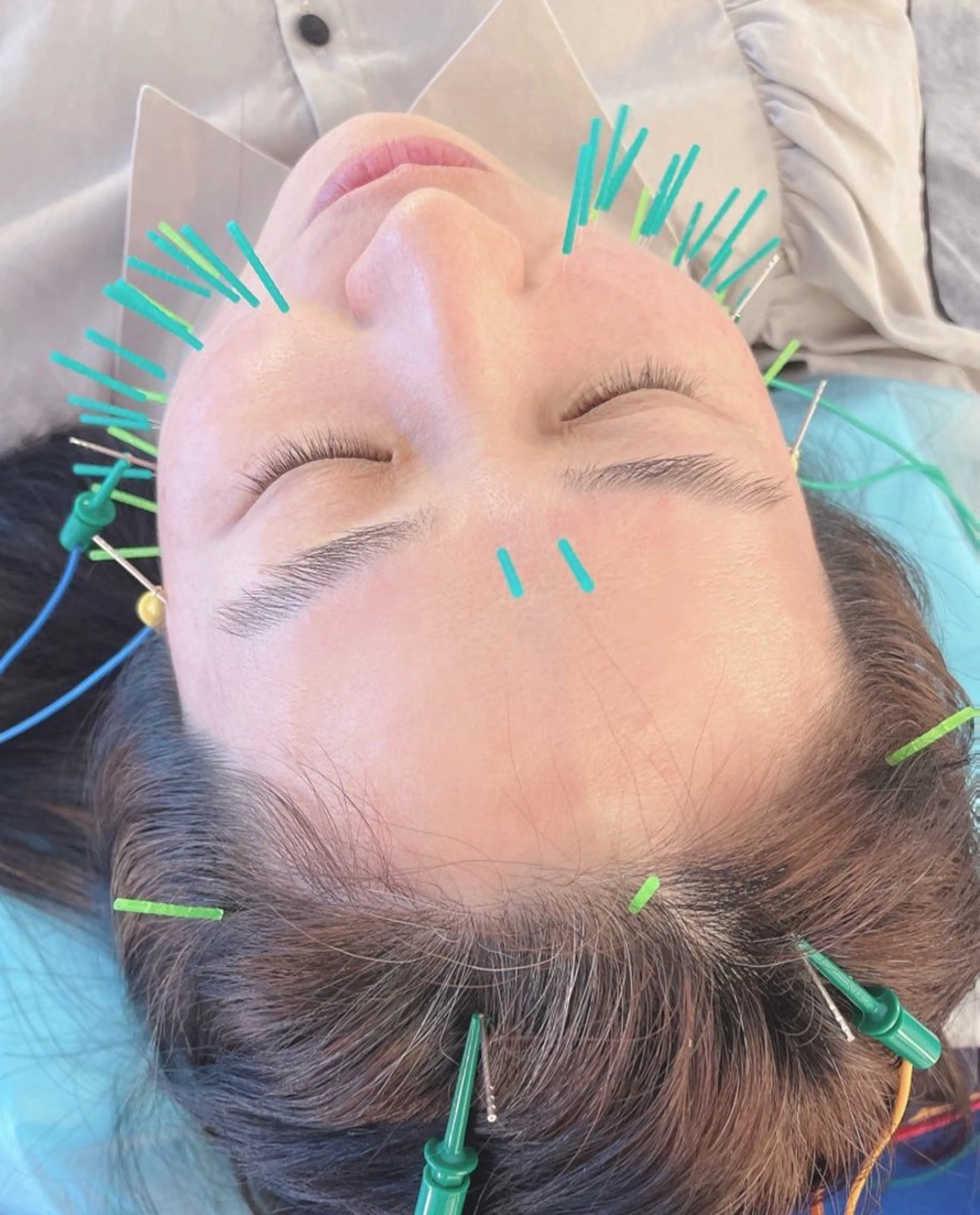 エステ リラク 小顔美容鍼専門サロン 渋谷YZのエステ・リラクイメージ