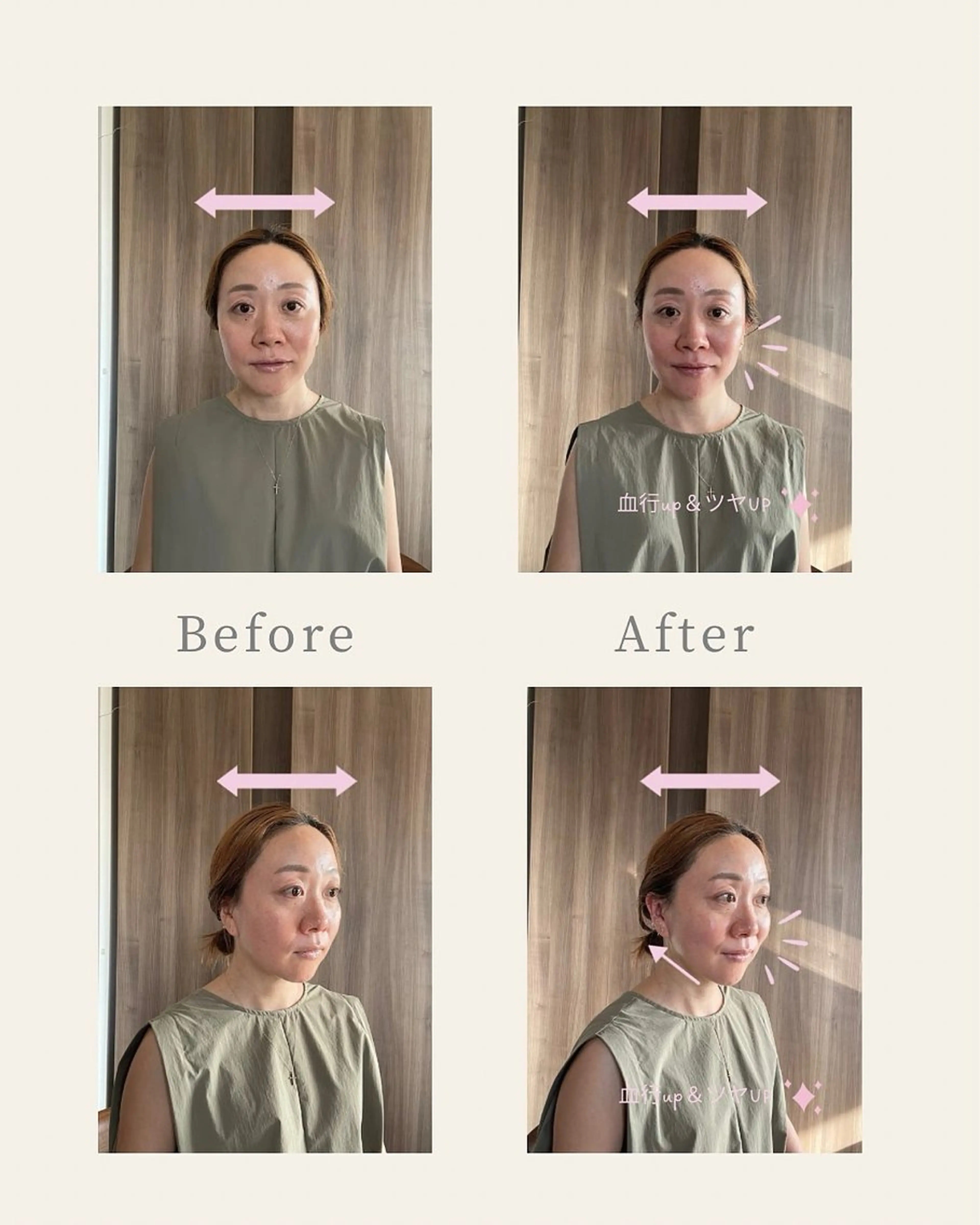 mimine エメラルド式耳つぼのその他イメージ