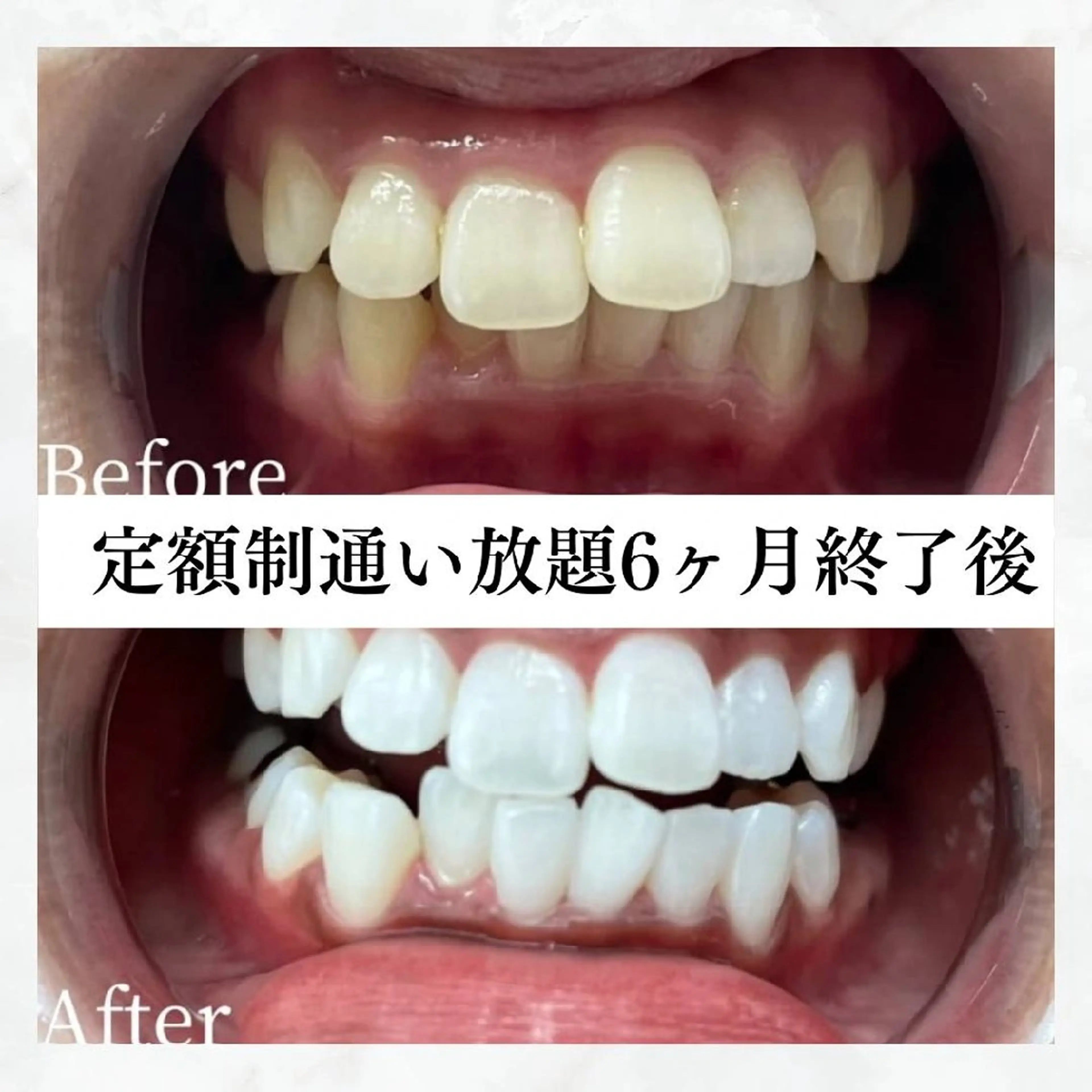 メンズ その他 ホワイトニングサロン WHITE福岡博多店のエステ・リラクイメージ