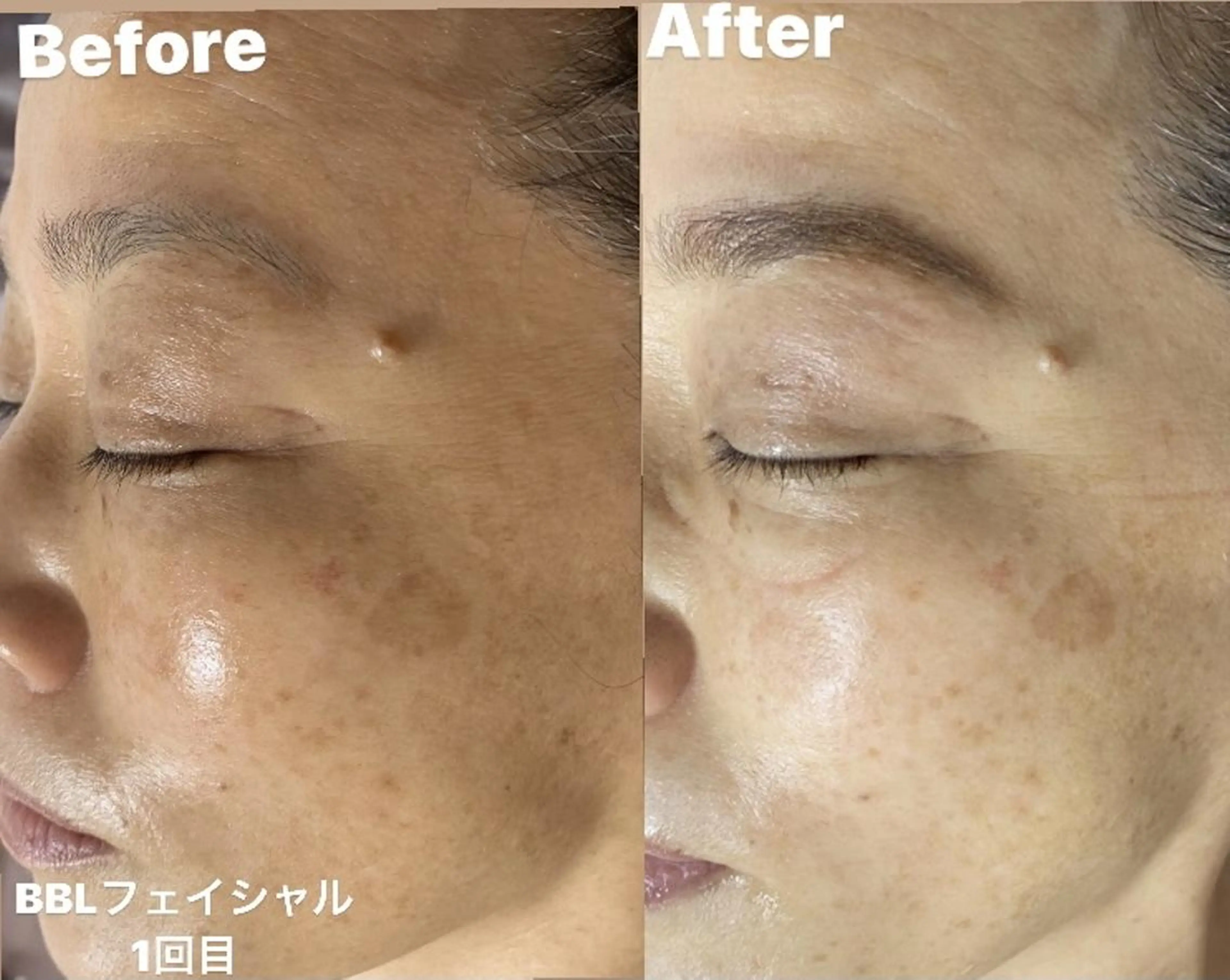 メンズ 脱毛 Epina 千葉店 【エピナ】のエステ・リラクイメージ