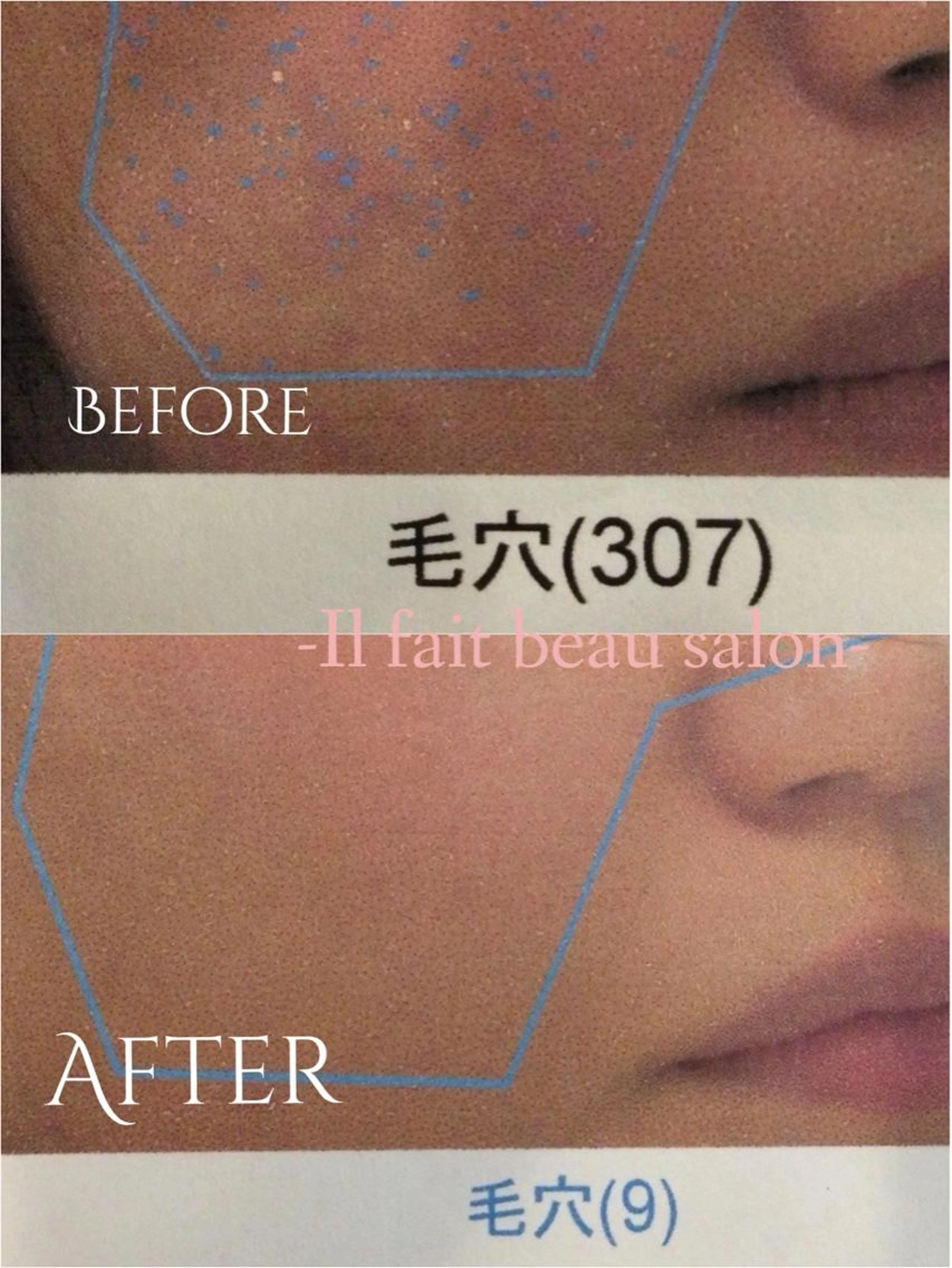 💎リピーター様限定💎美肌カウンセリング&スキンケア体験の写真