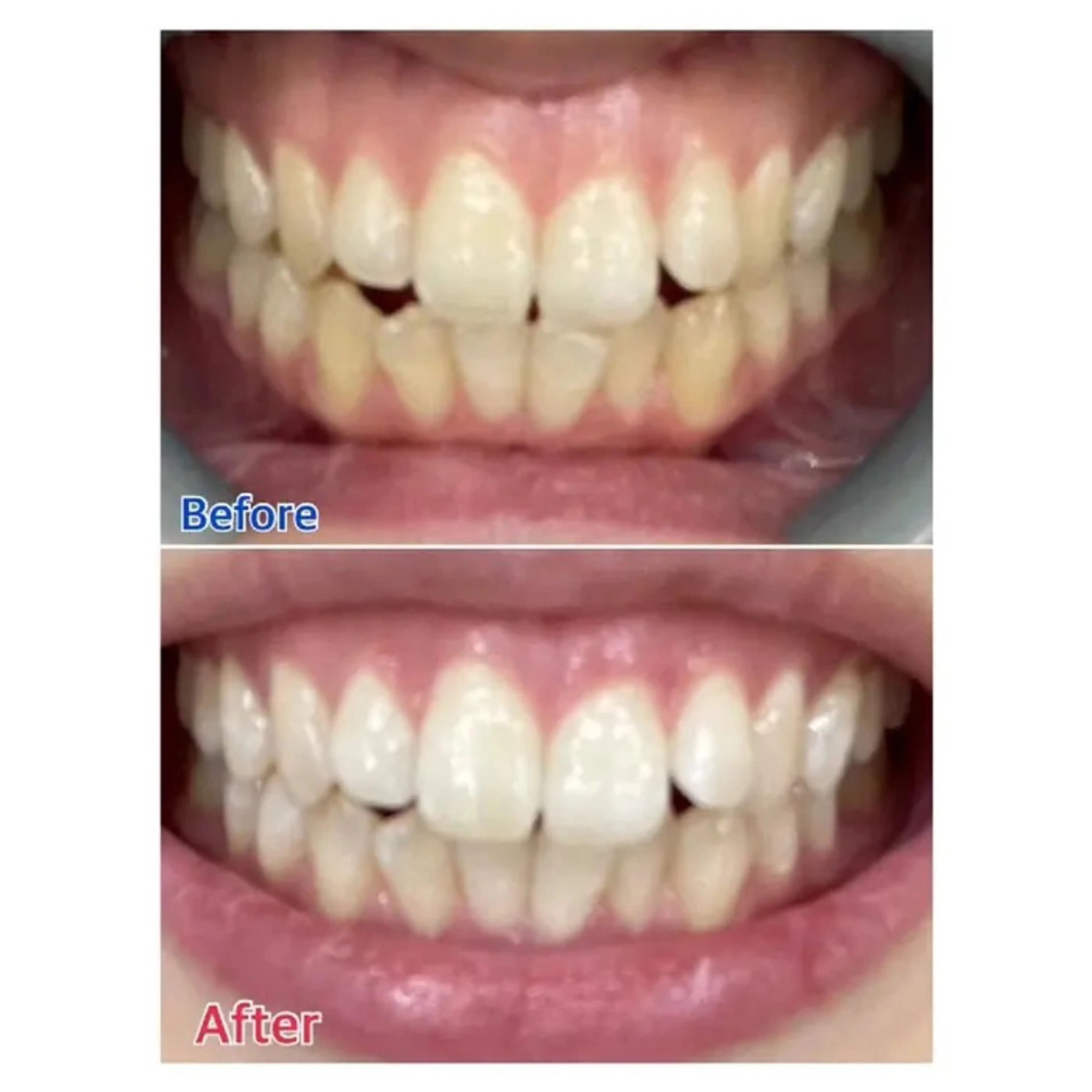 M渋谷店所属・M渋谷 ホワイトニングのエステ・リラクイメージ