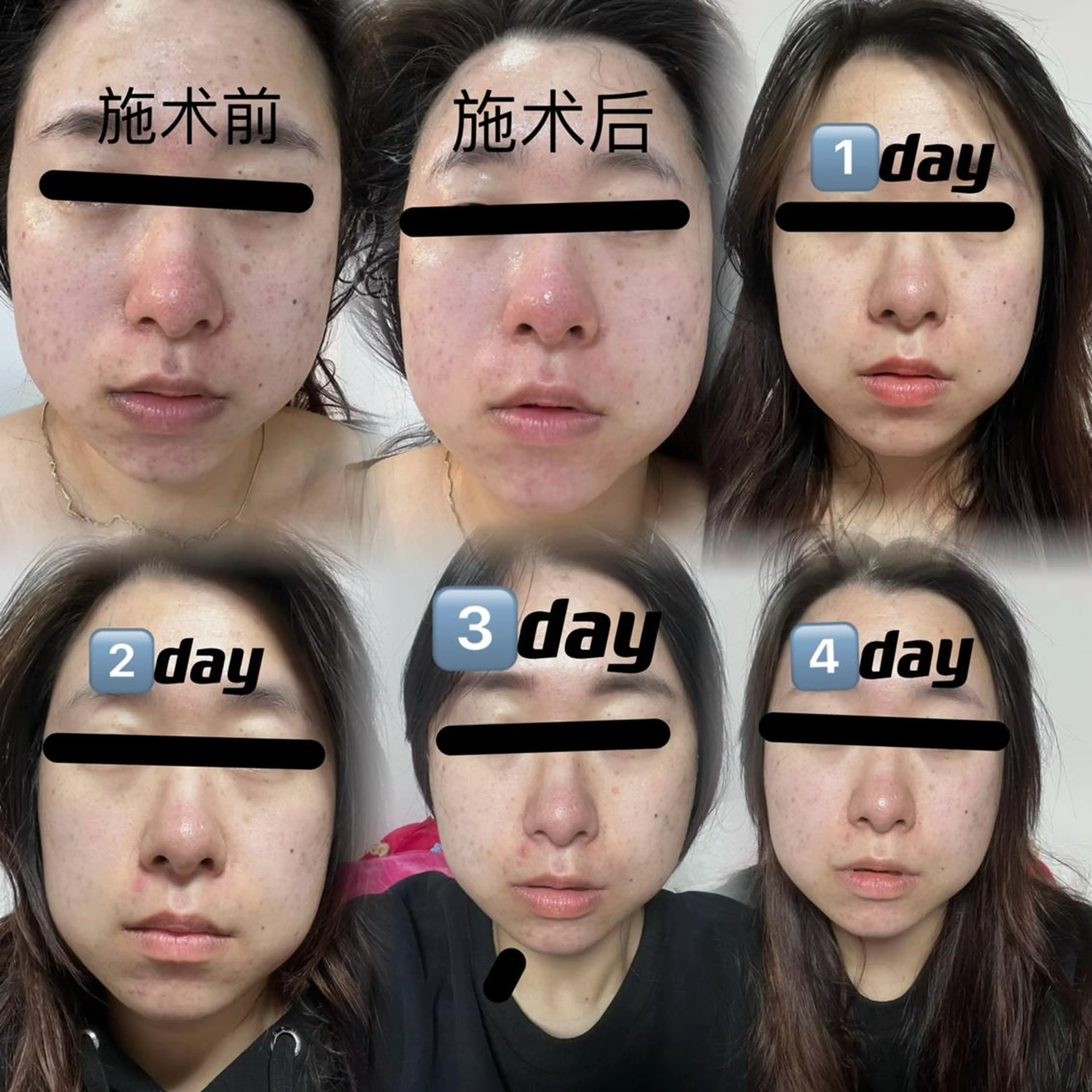 🧚‍♀️U・mi 菜々子のマツエク・マツパデザイン