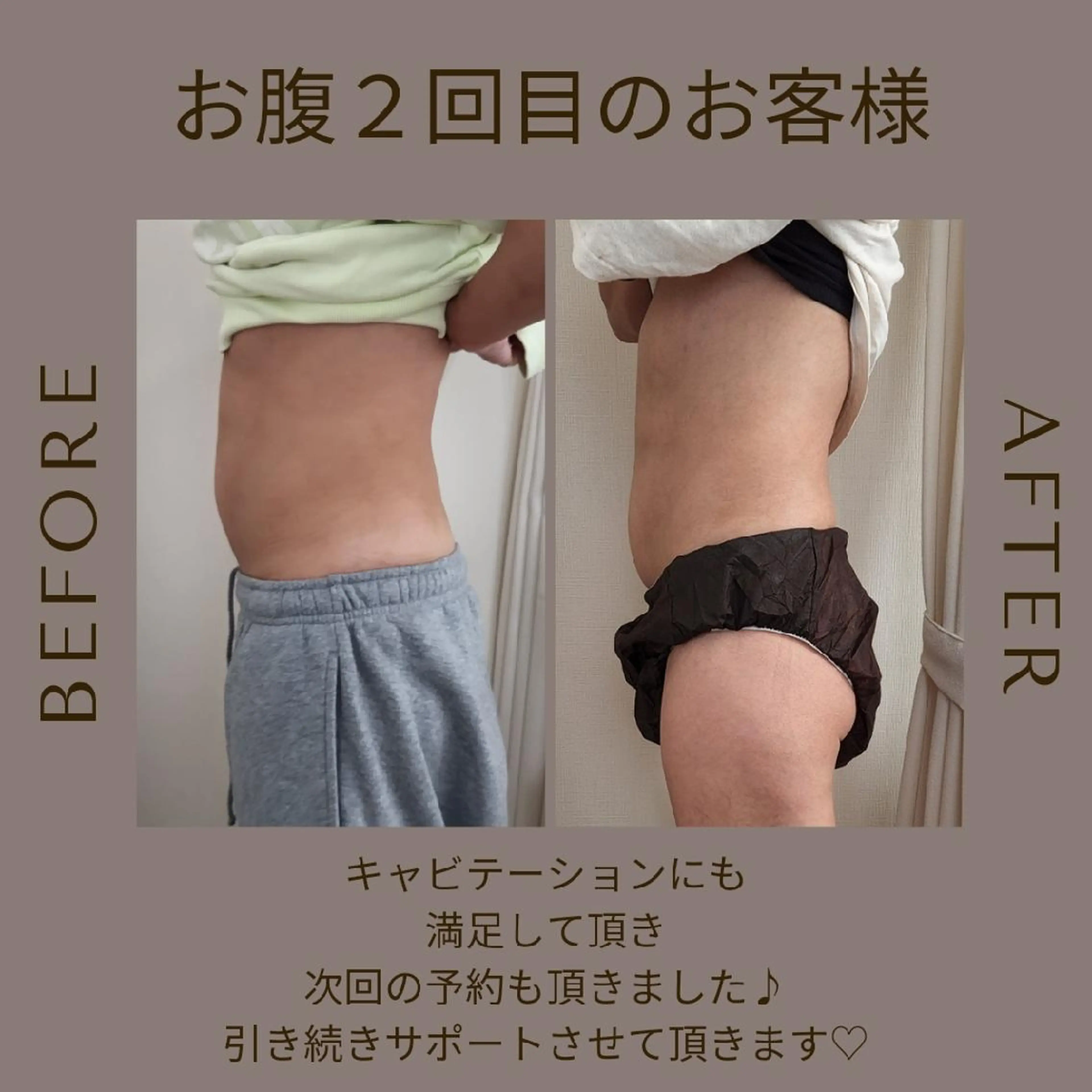 脂肪冷却・脱毛サロン coconoix のエステ・リラクイメージ