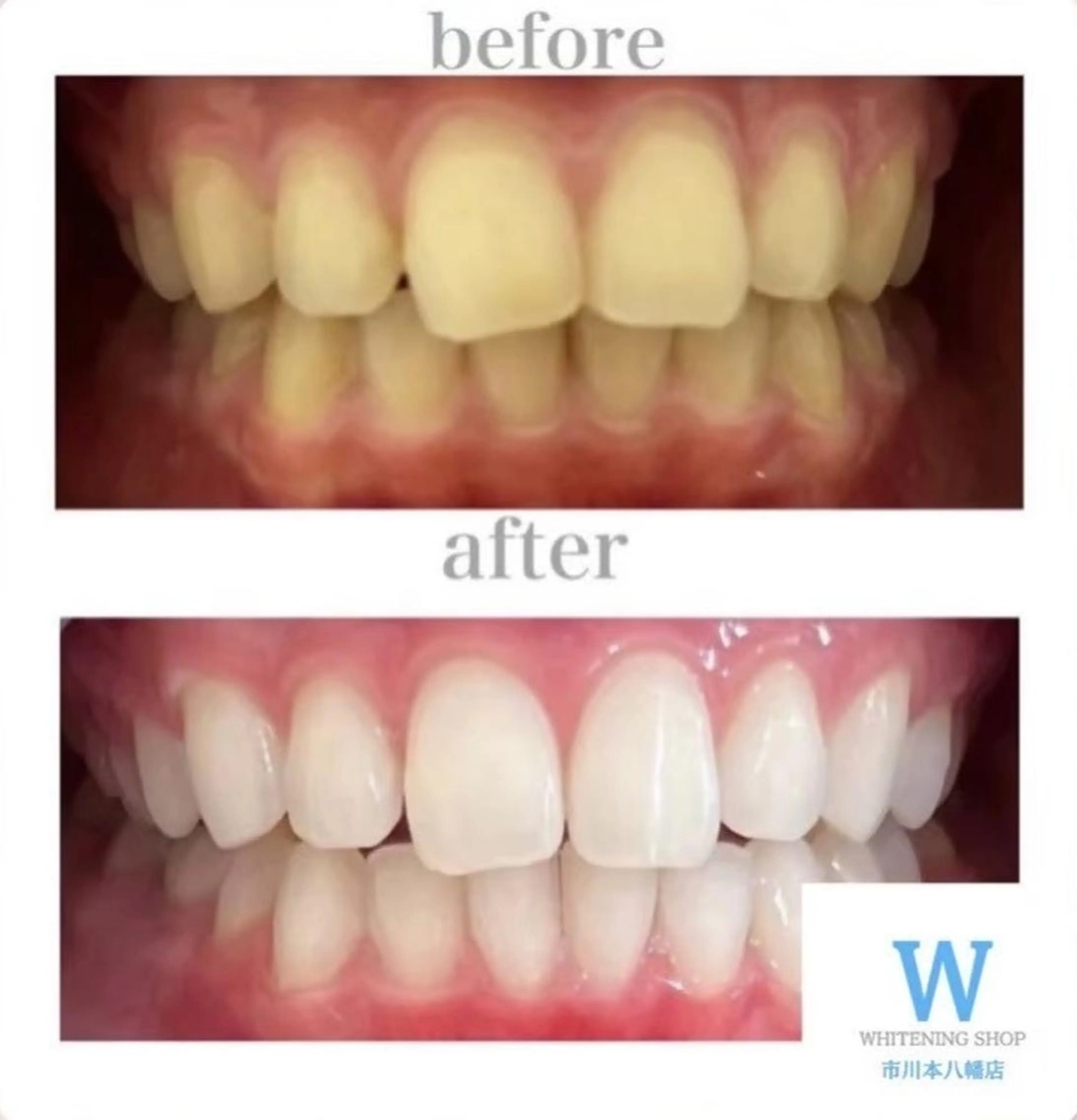 エステ リラク ホワイトニング ショップ本八幡店のエステ・リラクイメージ