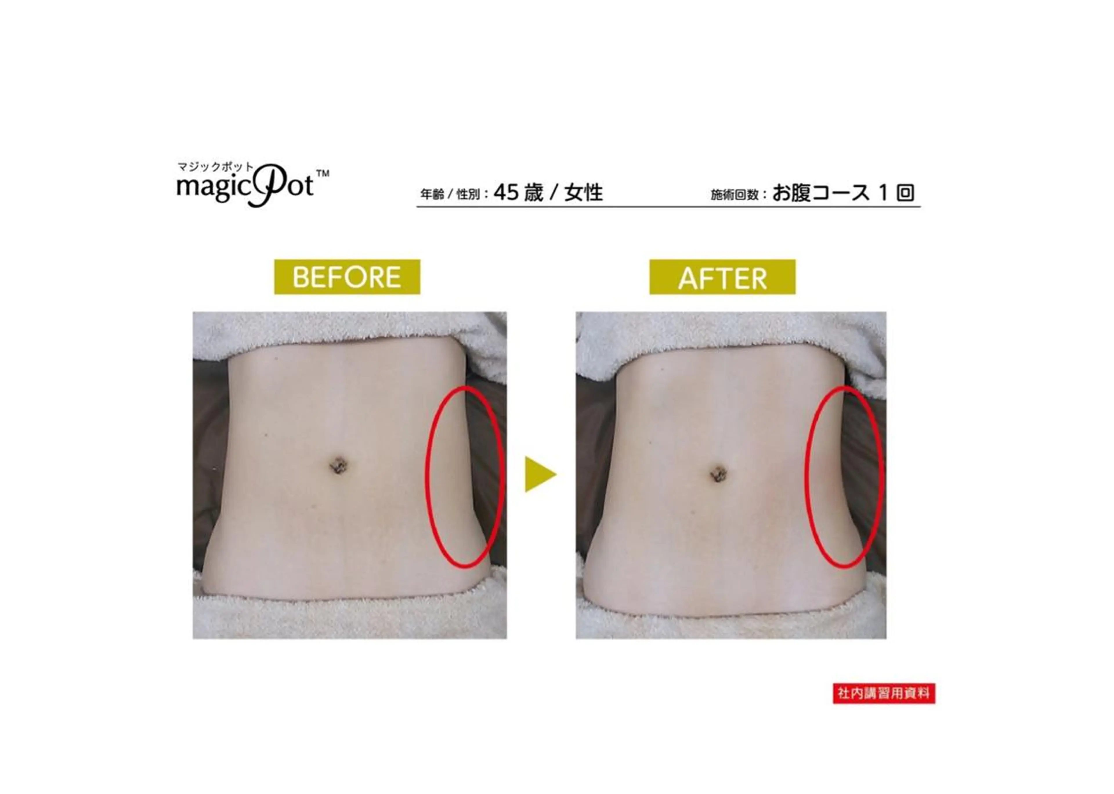 脱毛・エステサロン LuLuNのエステ・リラクイメージ