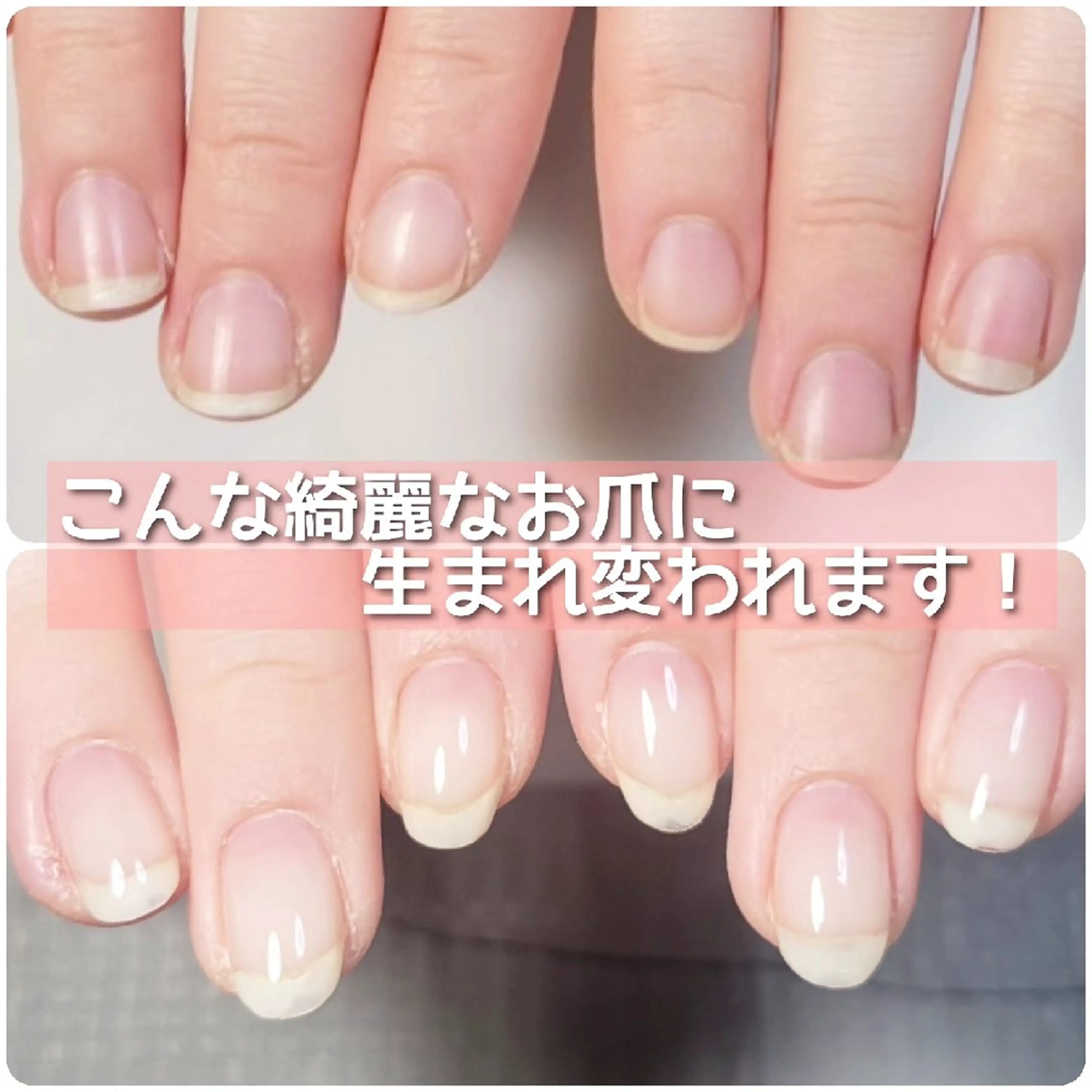 ネイル A*[エースター] シュガーリング🍋のエステ・リラクイメージ