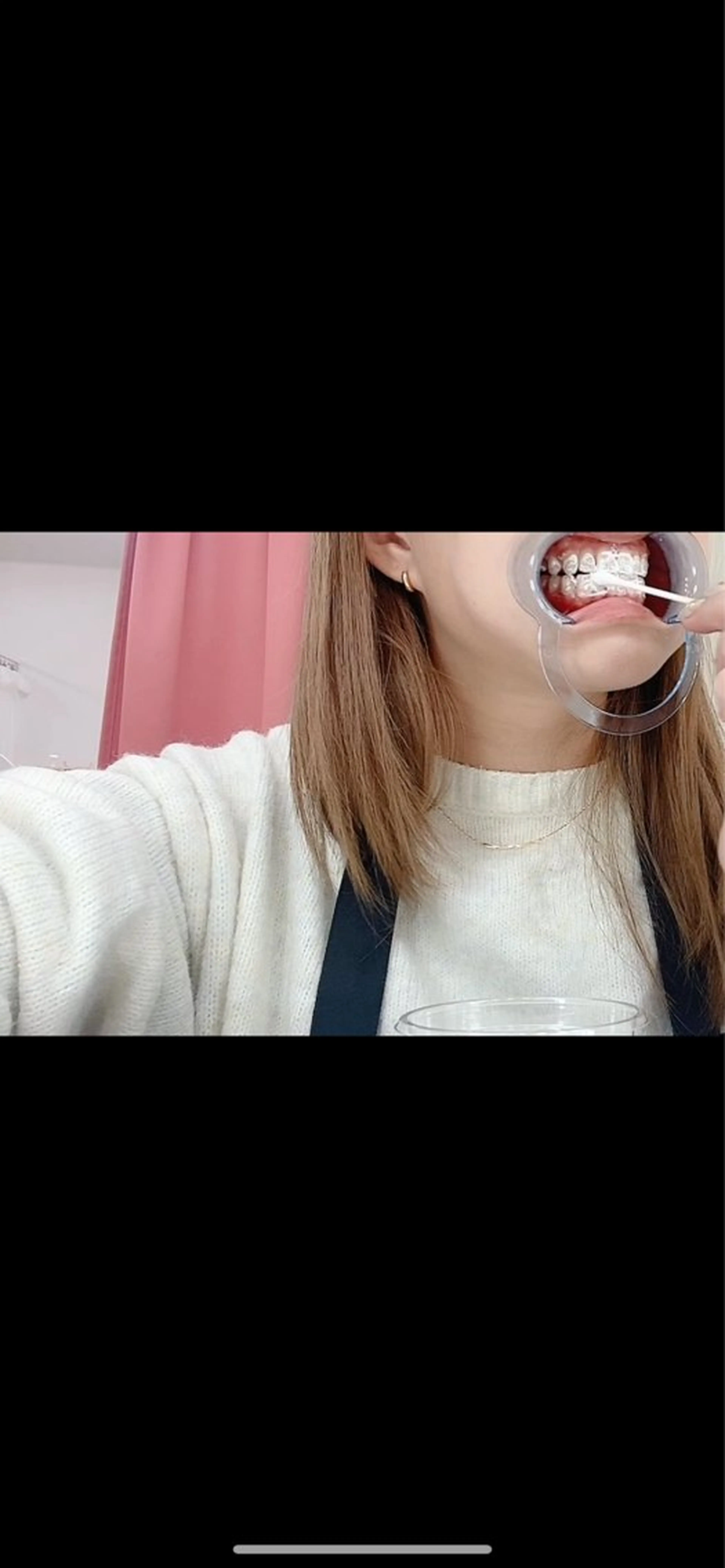 ecxia white 高田馬場所属・セルフホワイトニング エクシア 高田馬場のその他イメージ