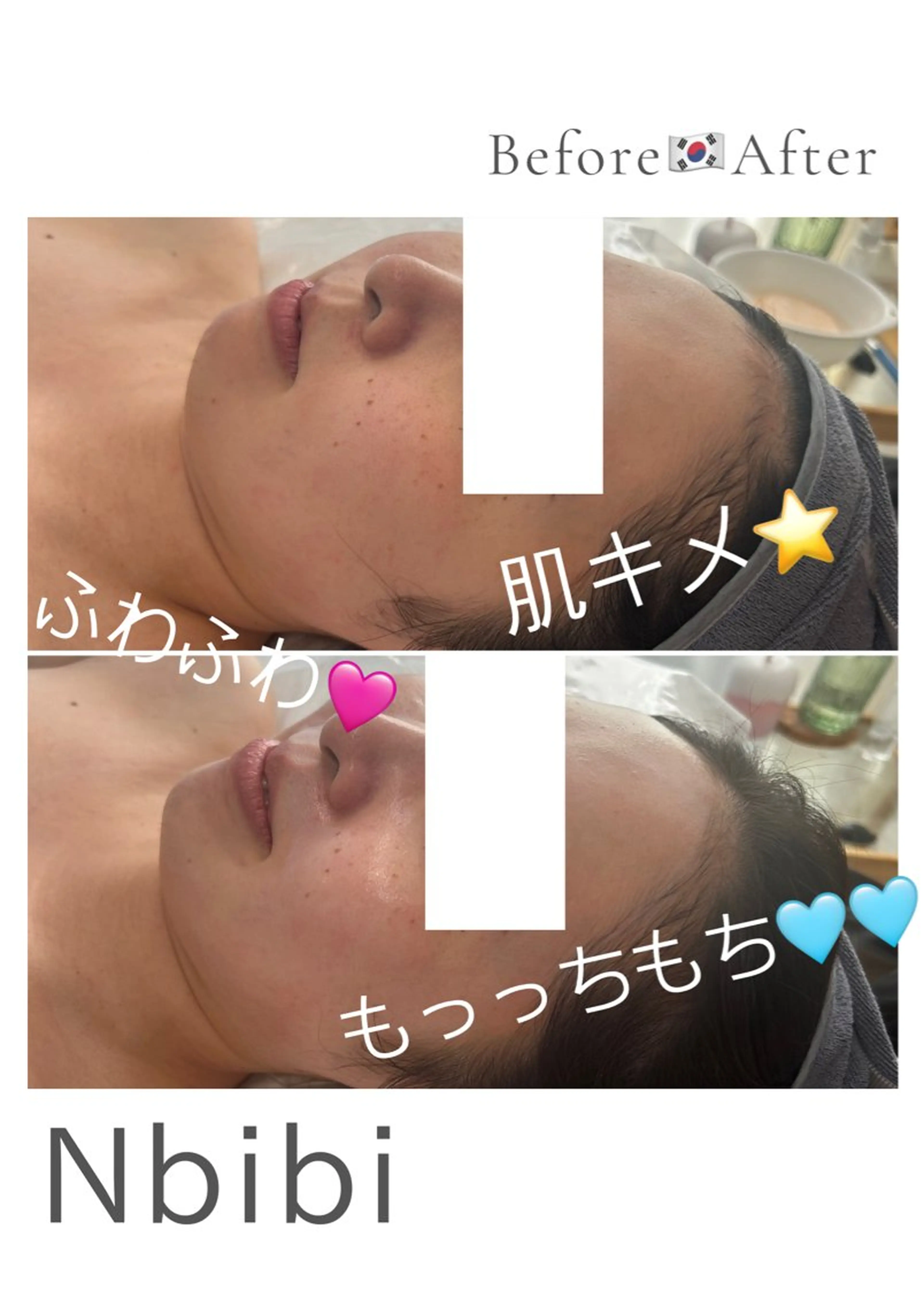 エステ 韓国🇰🇷価格 サロン_Nbibiのエステ・リラクイメージ