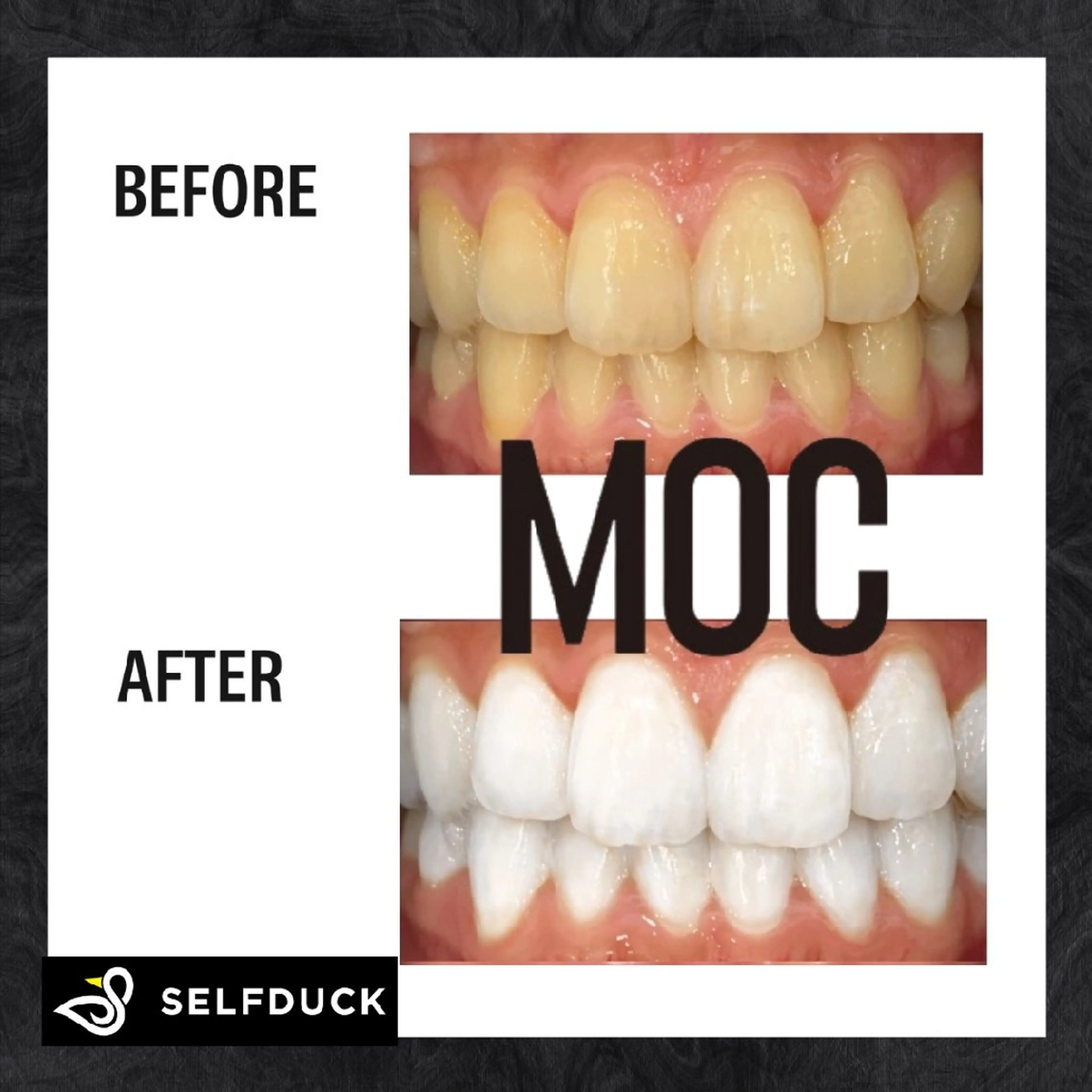 歯科提携セルフダック 宇都宮駒生店のエステ・リラクイメージ